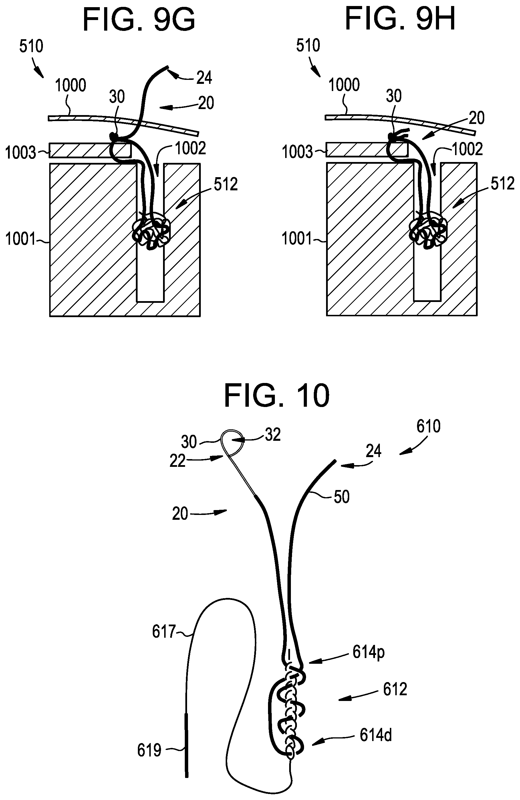 Patent US12310573 Figure 10 – Systems, devices, and methods for securing tissue using snare assemblies and soft anchors