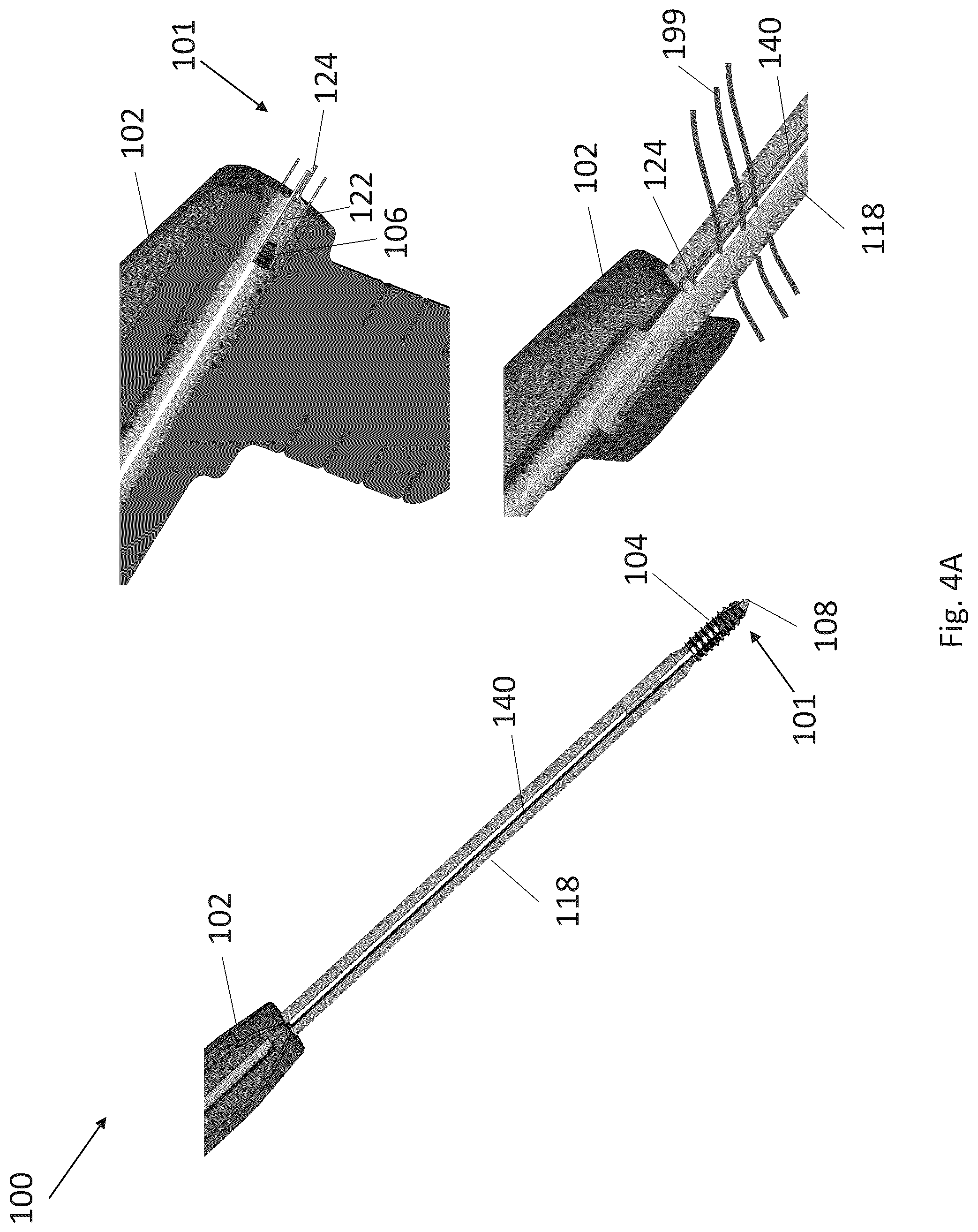 Patent US12310574 Figure 6 – Knotless suture anchor with re-tension features