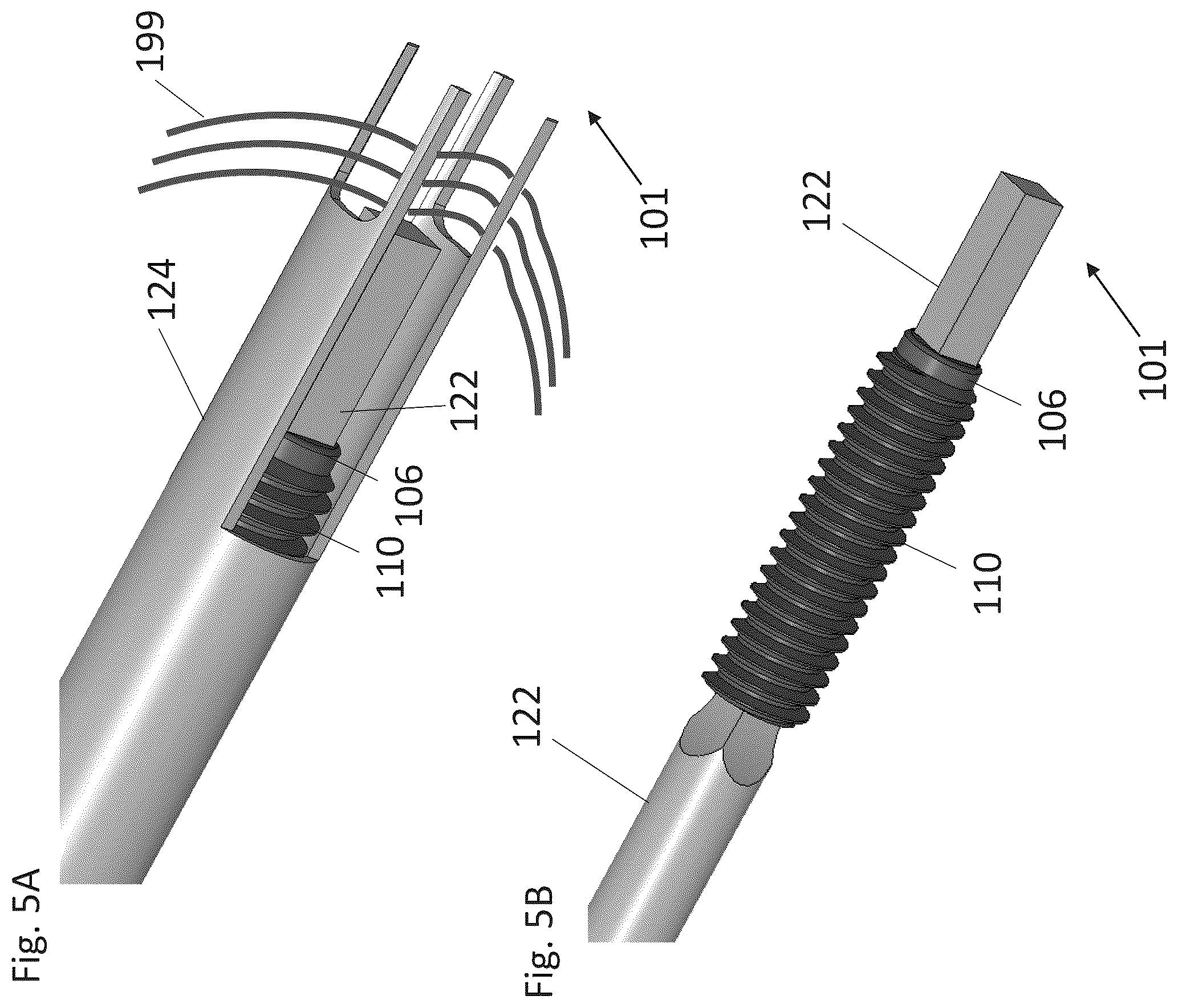 Patent US12310574 Figure 7 – Knotless suture anchor with re-tension features
