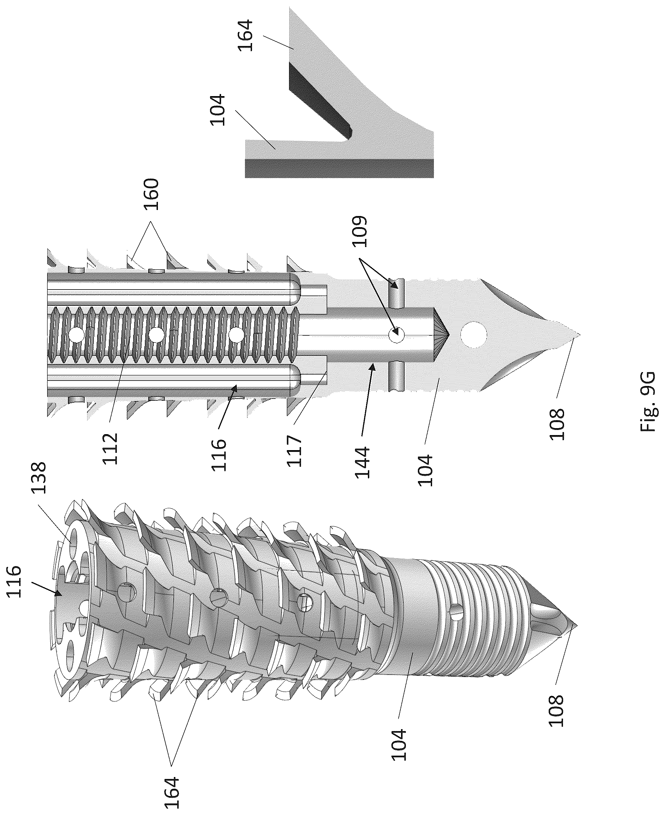 Patent US12310574 Figure 15 – Knotless suture anchor with re-tension features