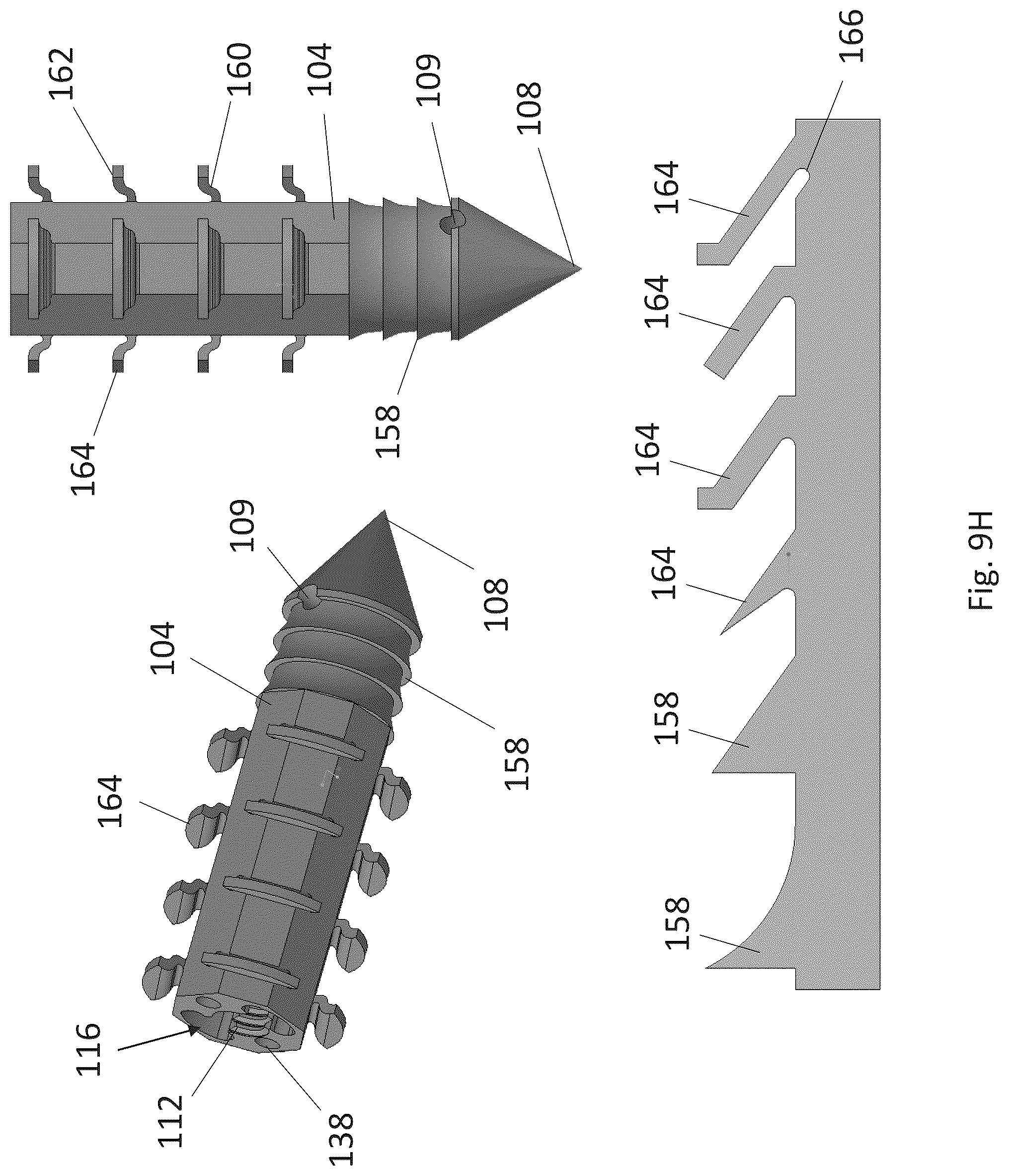 Patent US12310574 Figure 16 – Knotless suture anchor with re-tension features