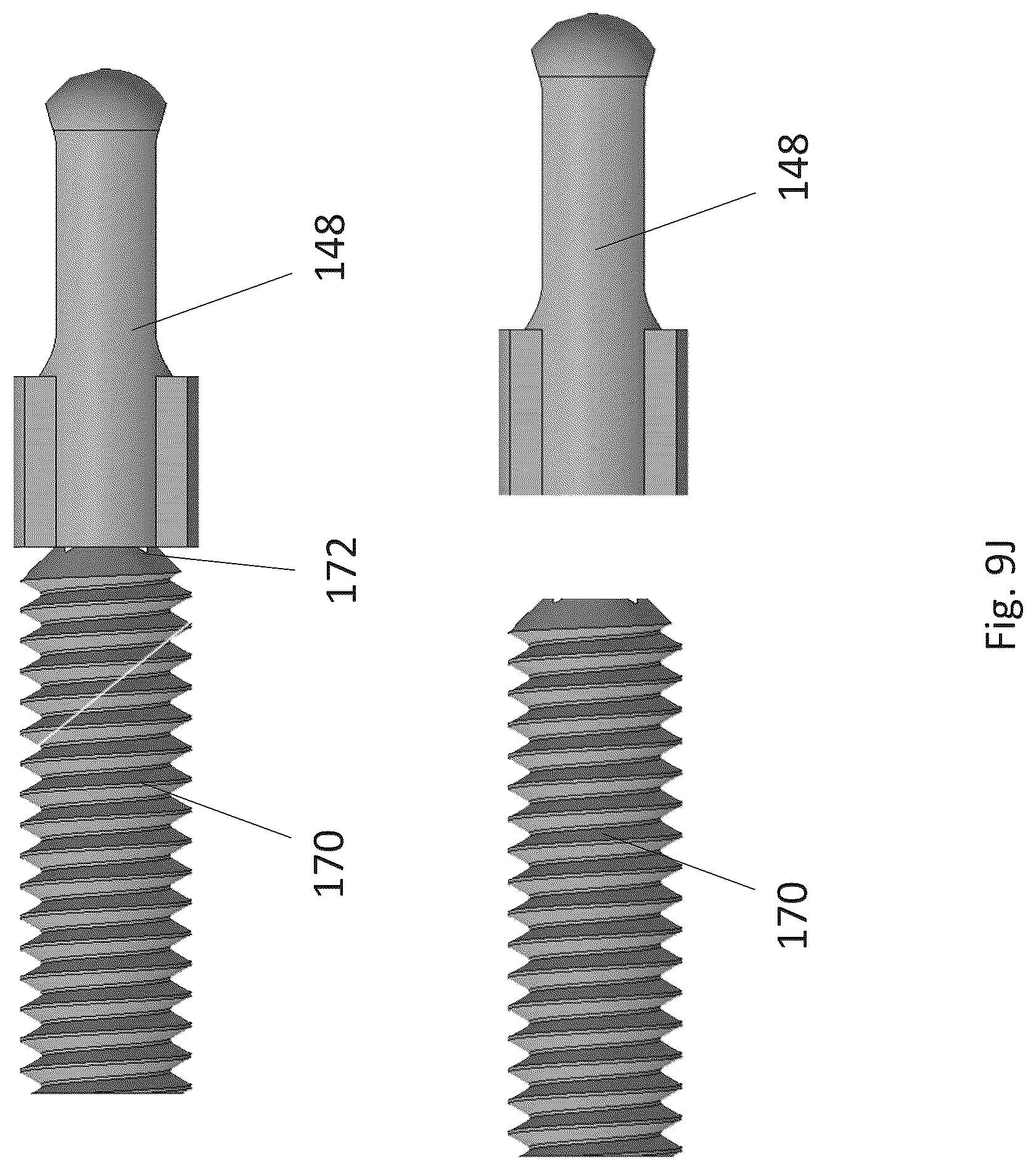 Patent US12310574 Figure 18 – Knotless suture anchor with re-tension features