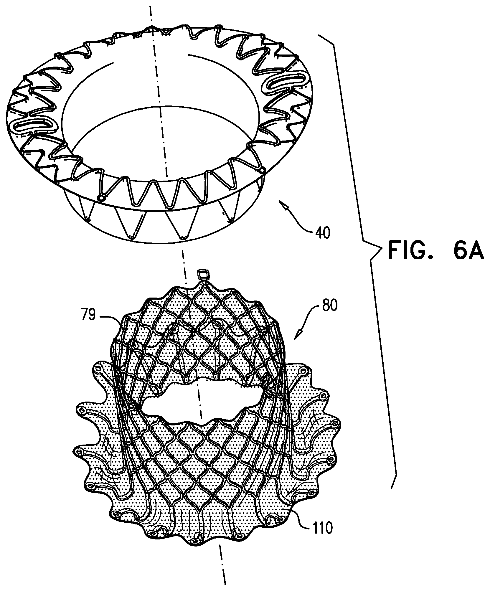 Patent US12310575 Figure 15 – Helical anchor implantation