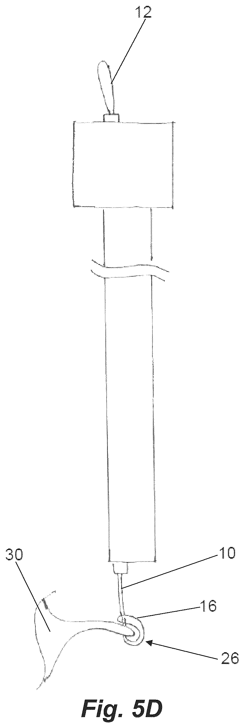 Patent US12310577 Figure 12 – Device for suture attachment for minimally invasive heart valve repair