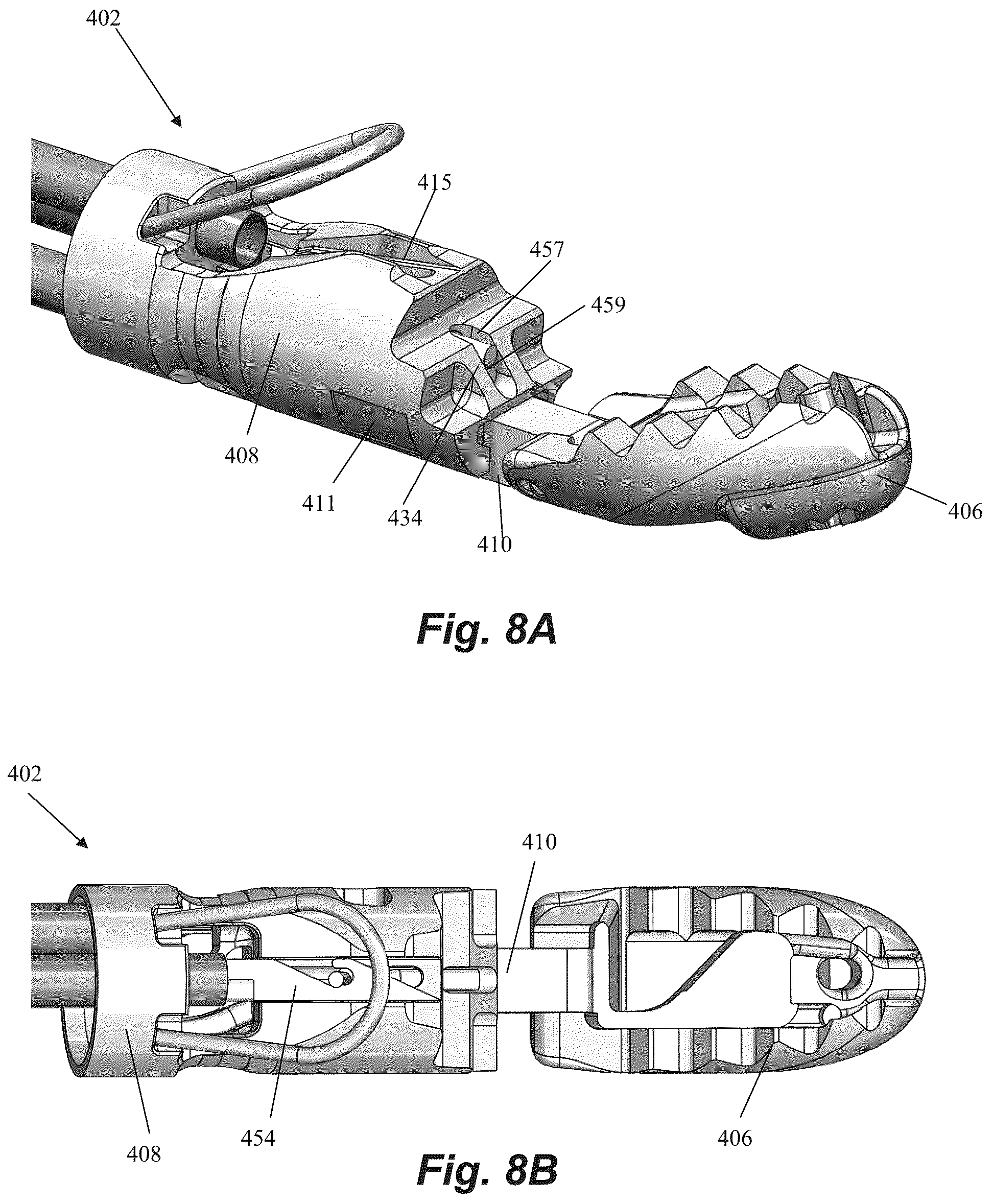 Patent US12310577 Figure 15 – Device for suture attachment for minimally invasive heart valve repair