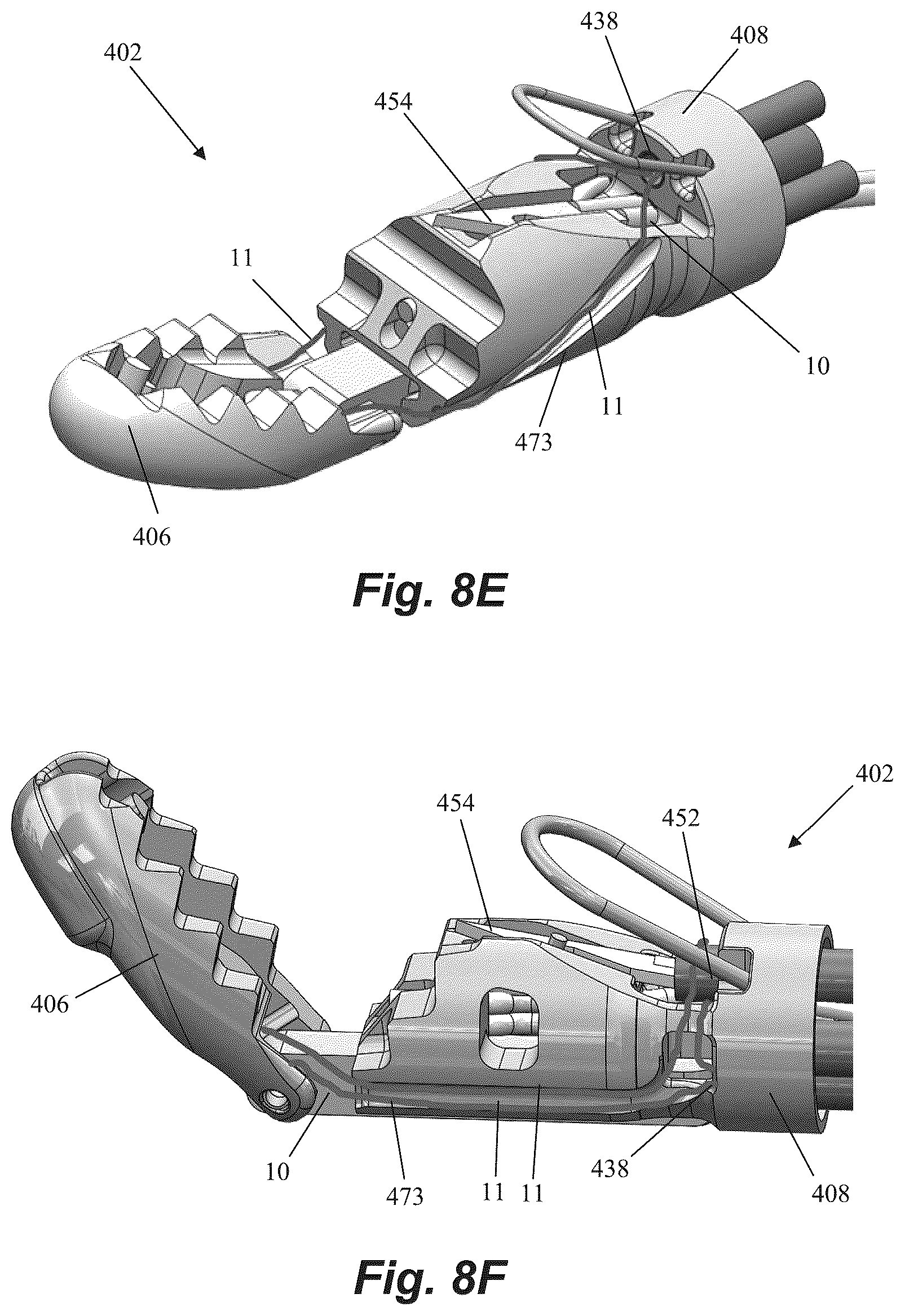 Patent US12310577 Figure 17 – Device for suture attachment for minimally invasive heart valve repair