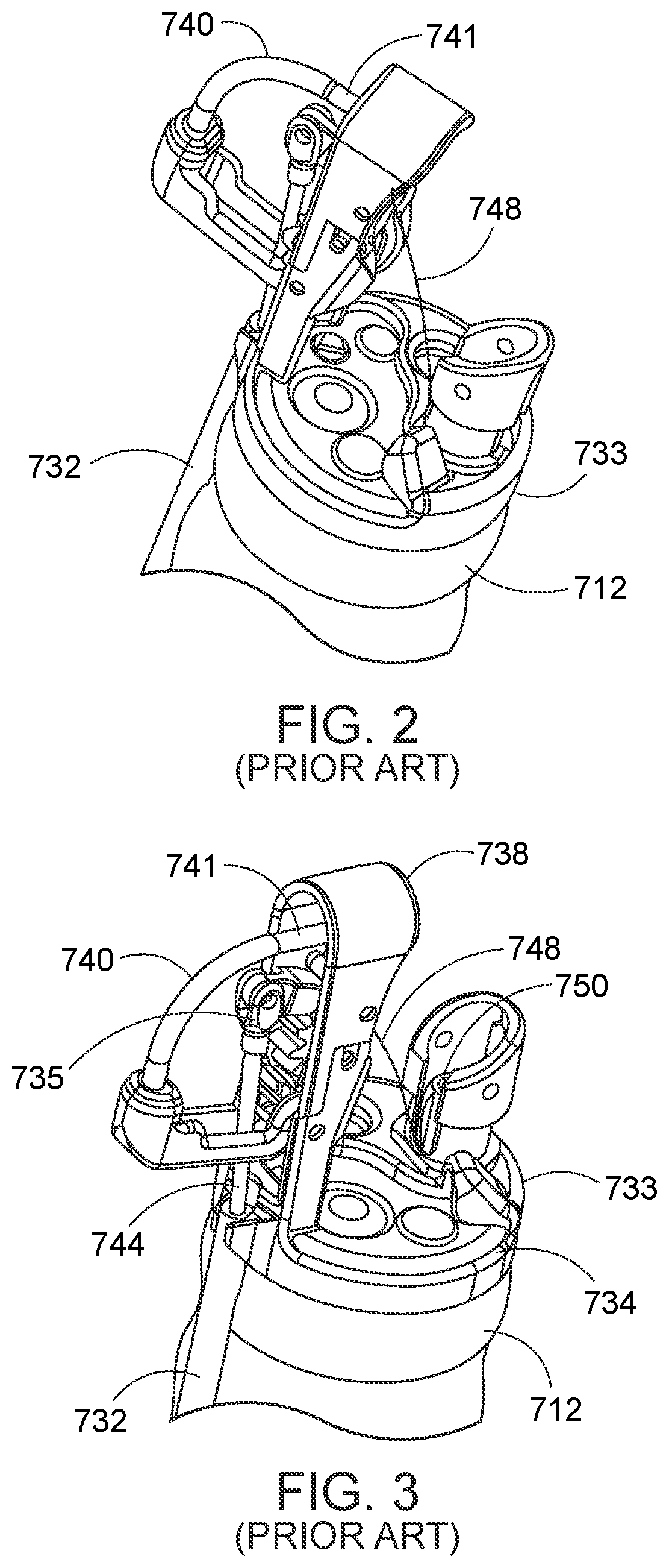 Patent US12310578 Figure 2 – Endoscopic suture loop anchors and methods