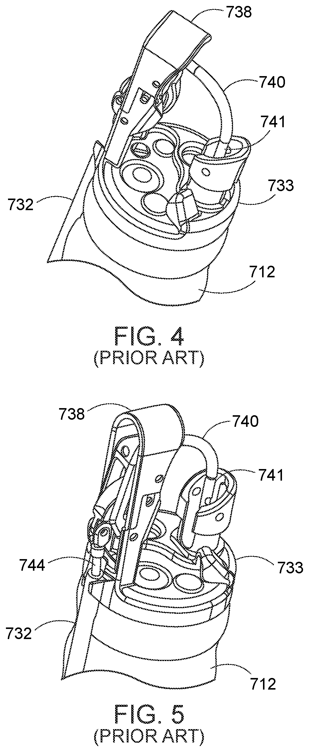 Patent US12310578 Figure 3 – Endoscopic suture loop anchors and methods