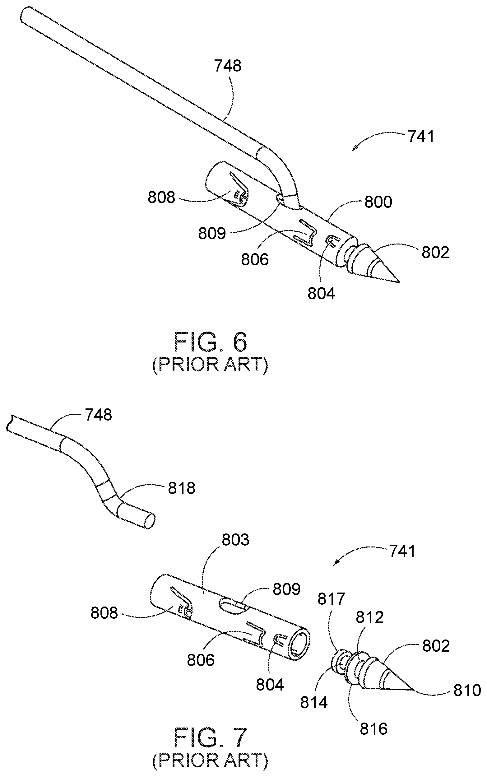 Patent US12310578 Figure 4 – Endoscopic suture loop anchors and methods