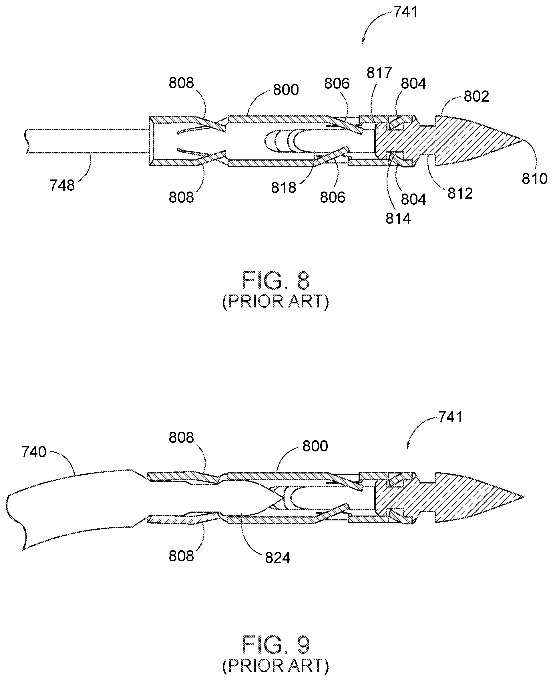 Patent US12310578 Figure 5 – Endoscopic suture loop anchors and methods