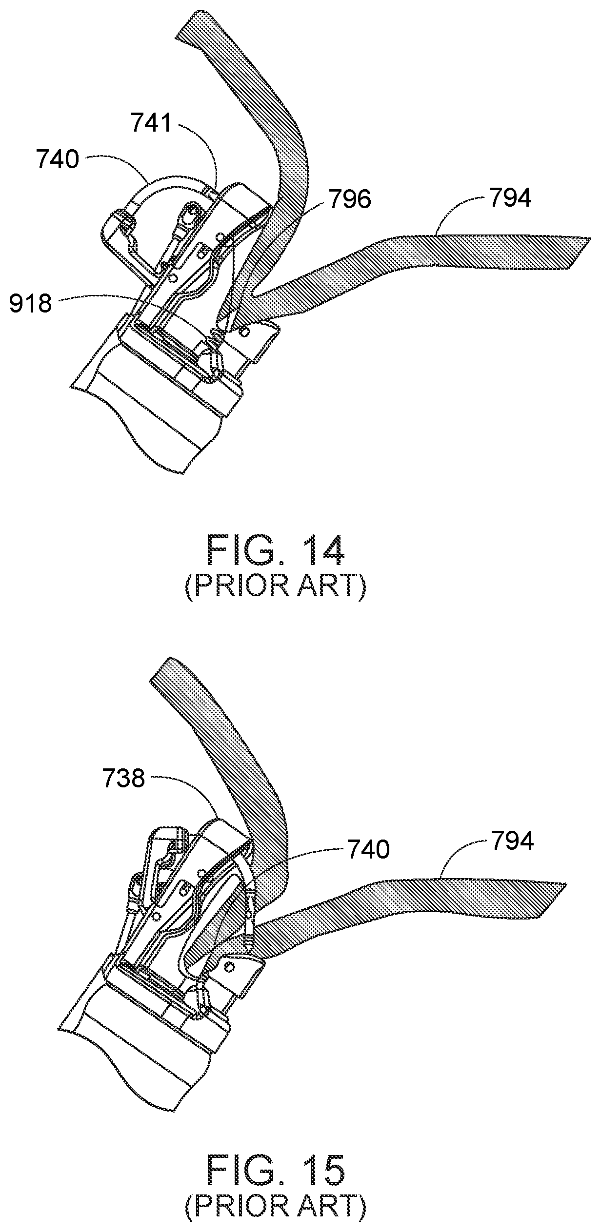 Patent US12310578 Figure 8 – Endoscopic suture loop anchors and methods