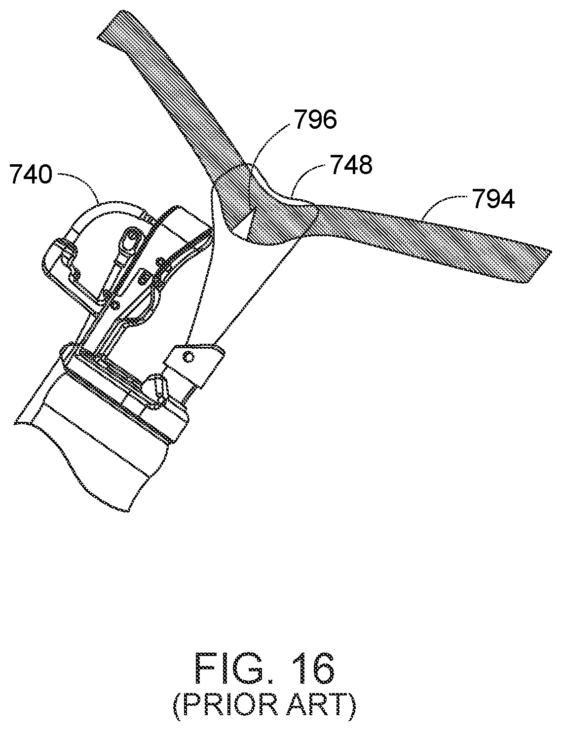 Patent US12310578 Figure 9 – Endoscopic suture loop anchors and methods