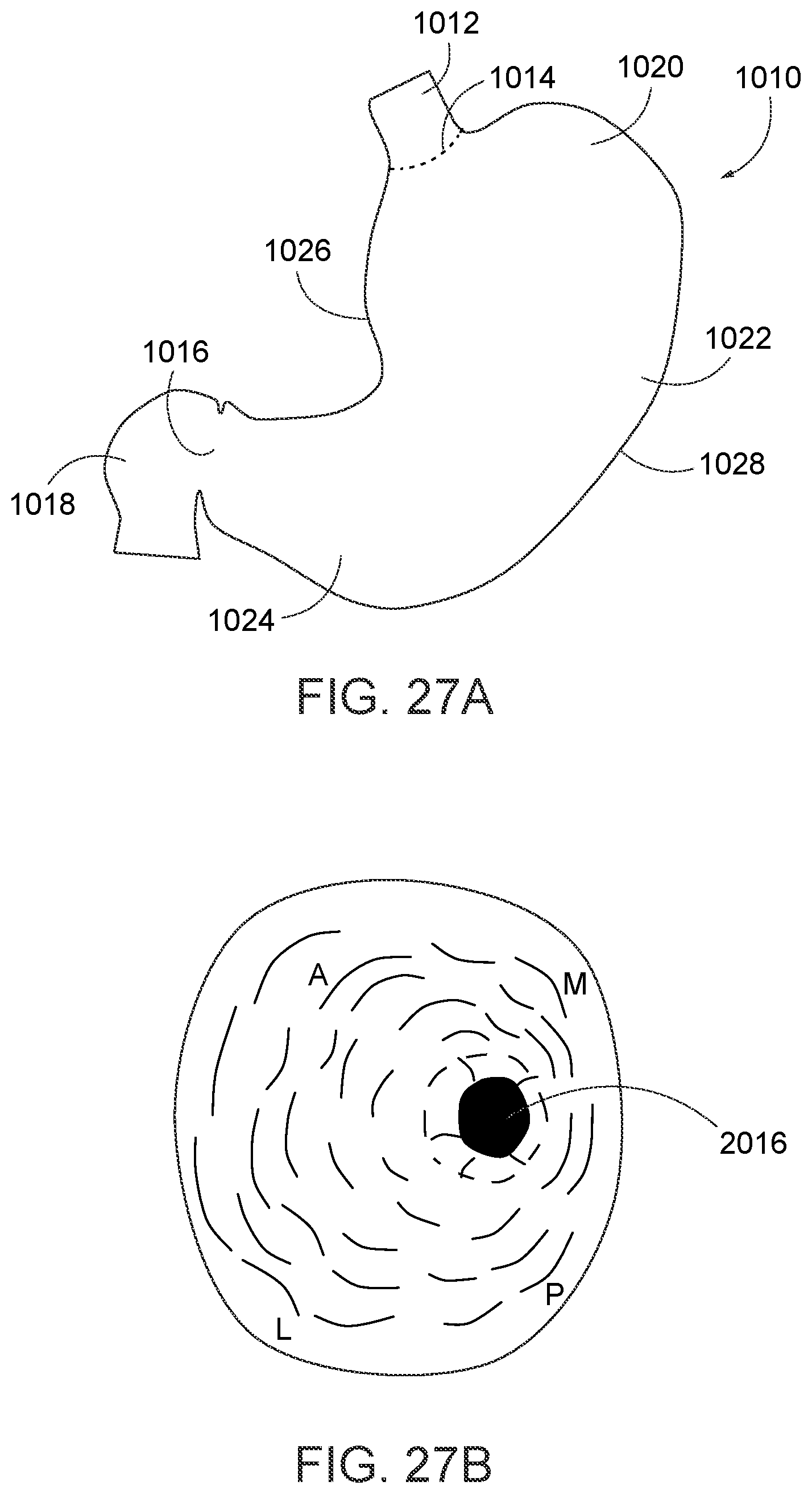 Patent US12310578 Figure 14 – Endoscopic suture loop anchors and methods
