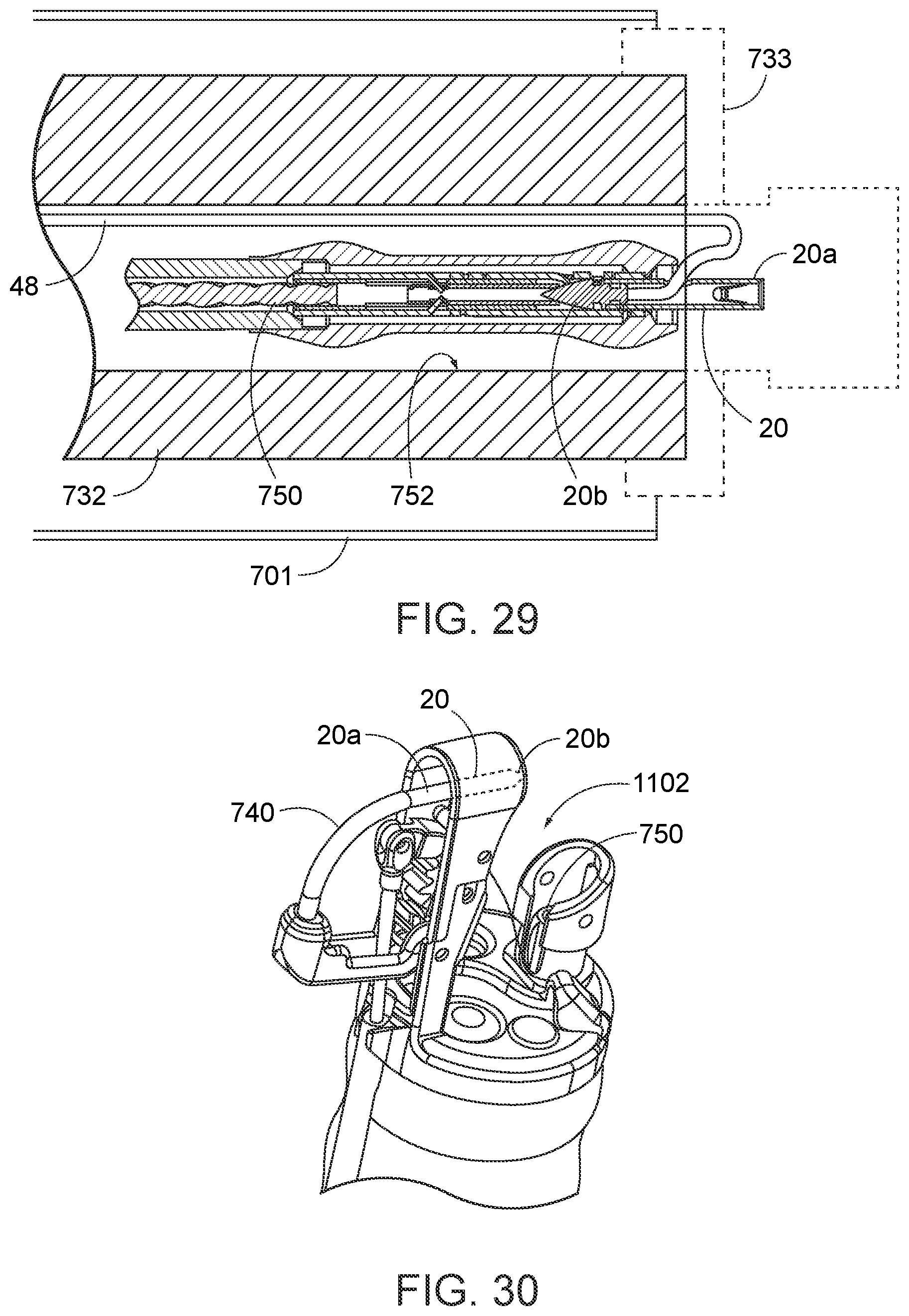 Patent US12310578 Figure 16 – Endoscopic suture loop anchors and methods