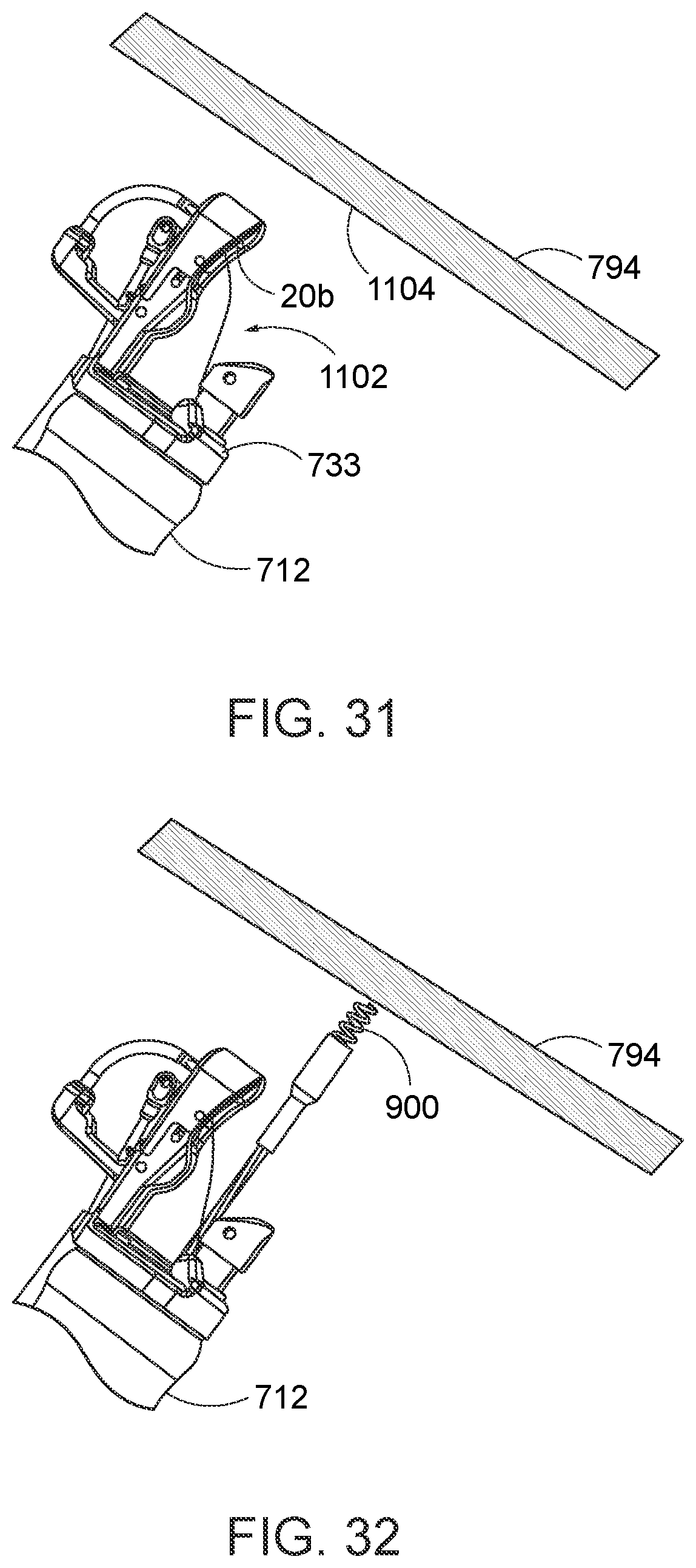 Patent US12310578 Figure 17 – Endoscopic suture loop anchors and methods
