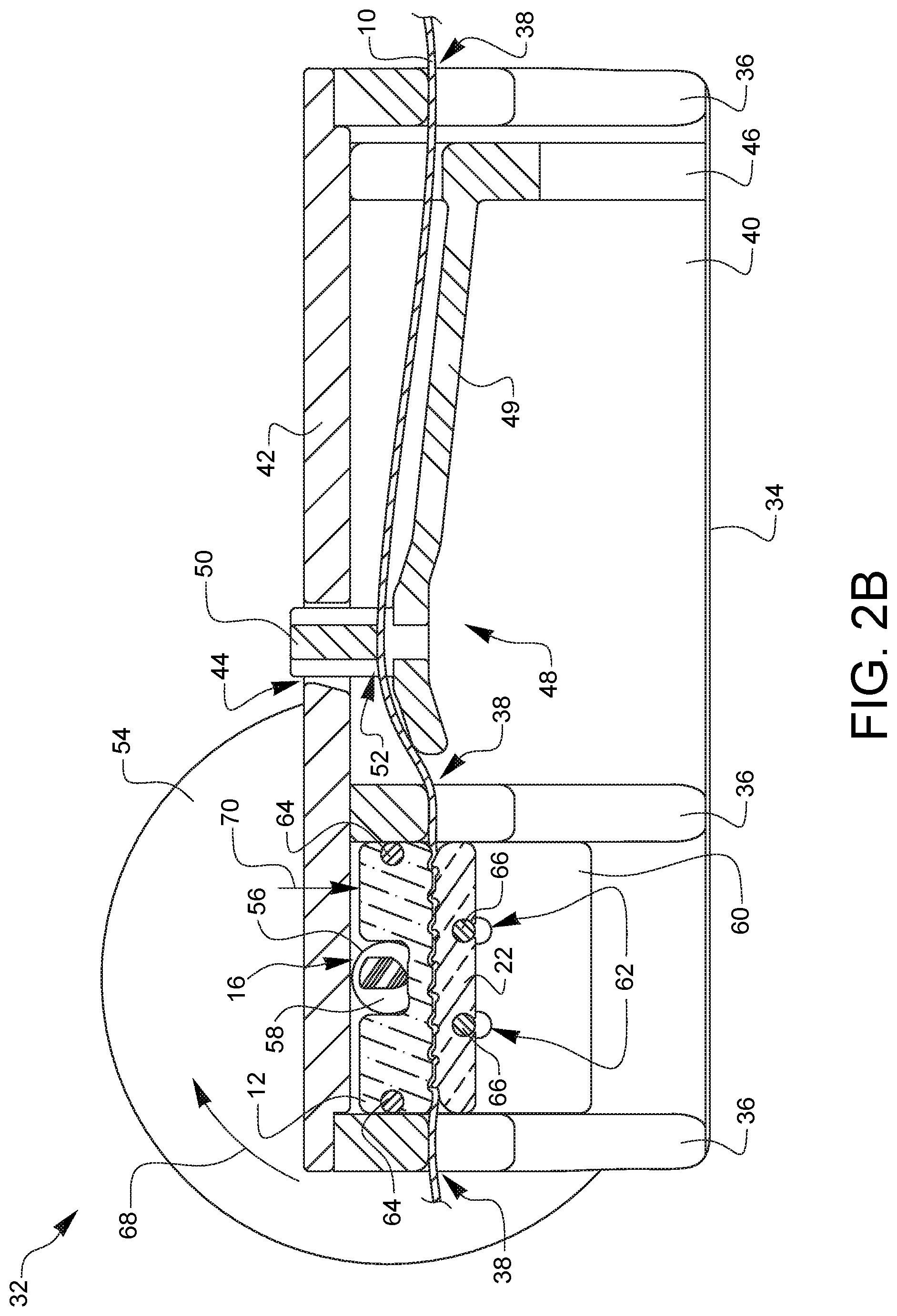 Patent US12310579 Figure 4 – Device for suture tensioning and methods thereof