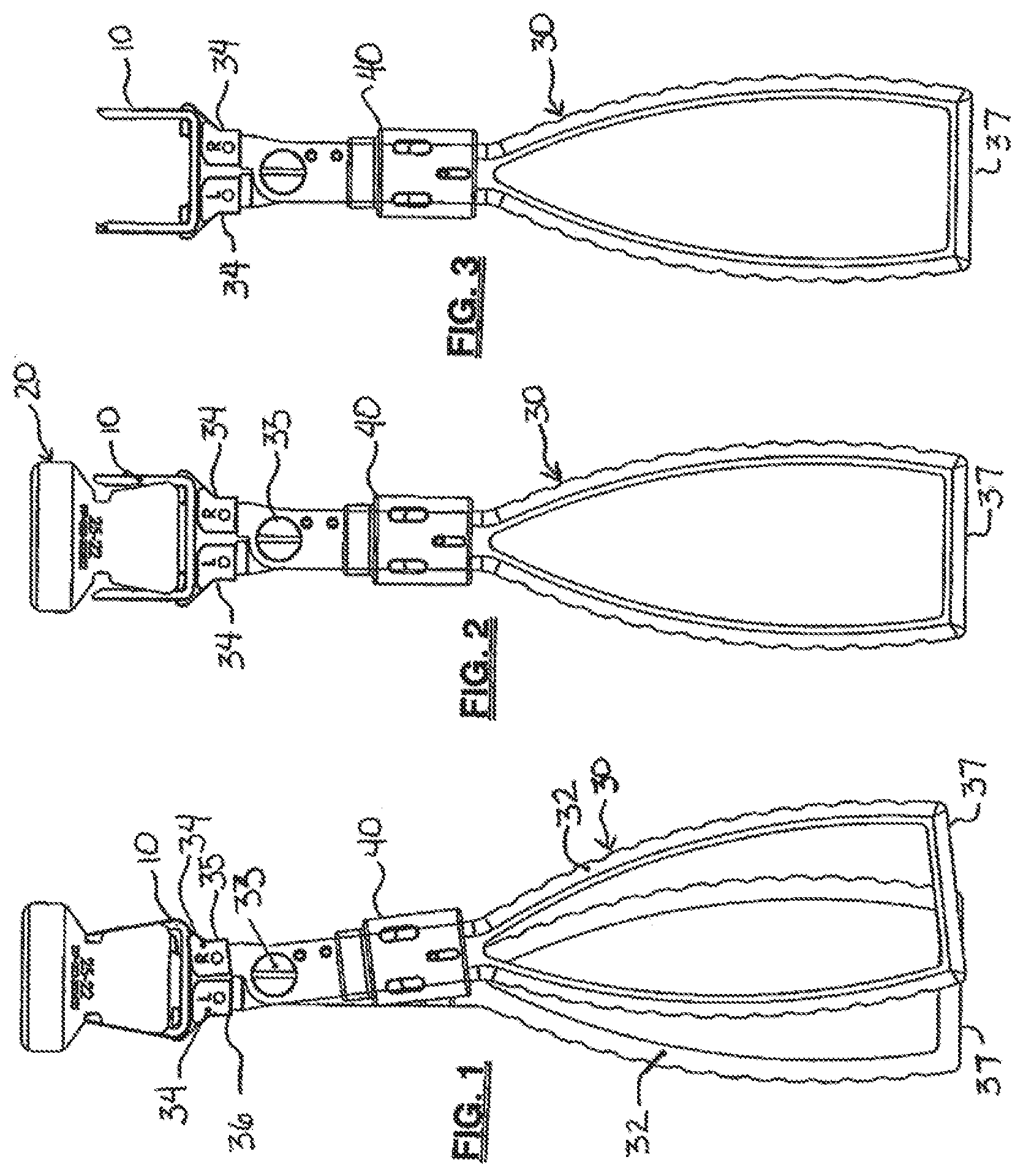 Patent US12310580 Figure 1 – Bone staple storage, inserter, and method for use therewith