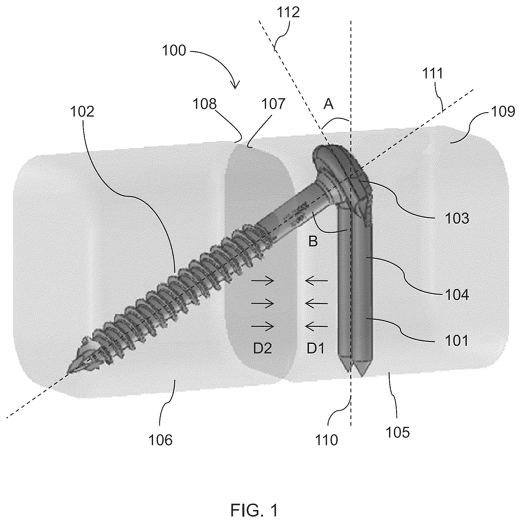 Patent US12310581 Figure 1 – Fixation assembly and method of use