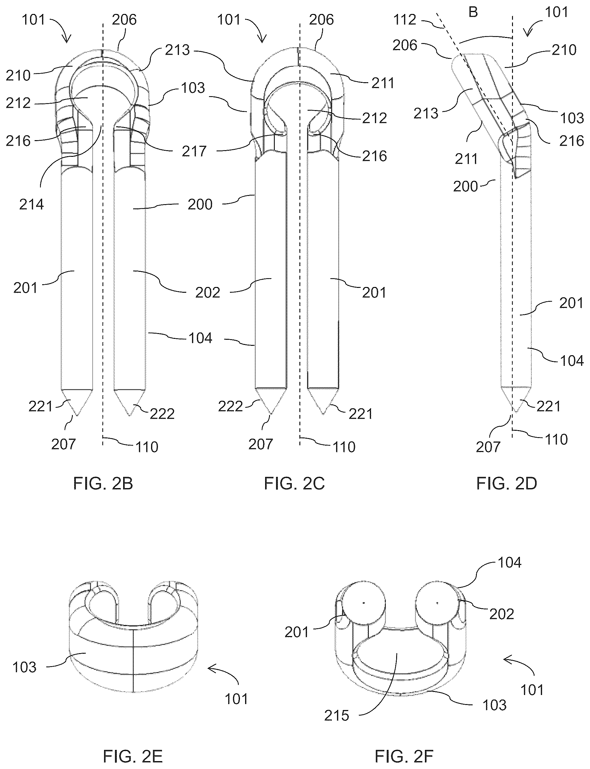Patent US12310581 Figure 3 – Fixation assembly and method of use