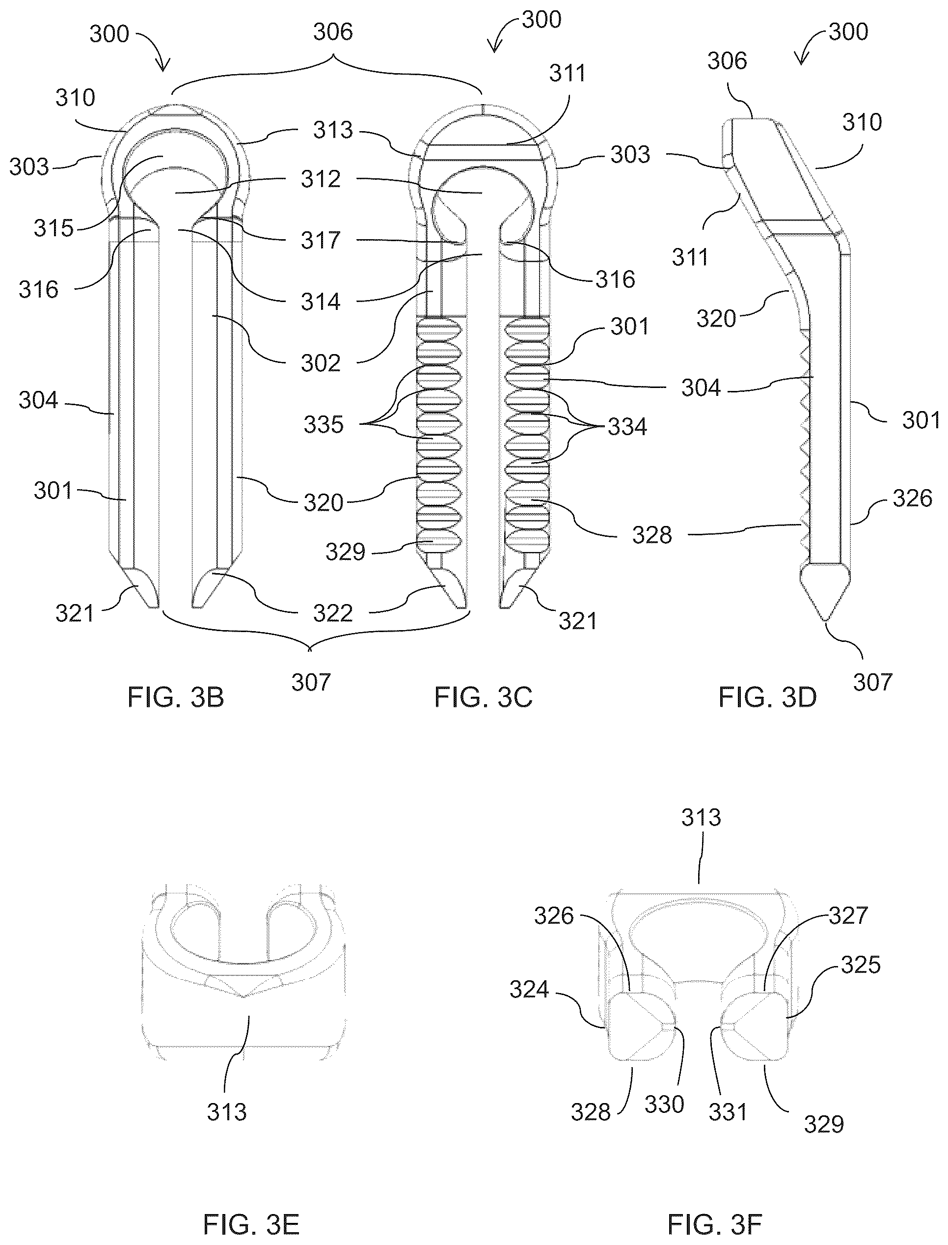 Patent US12310581 Figure 5 – Fixation assembly and method of use