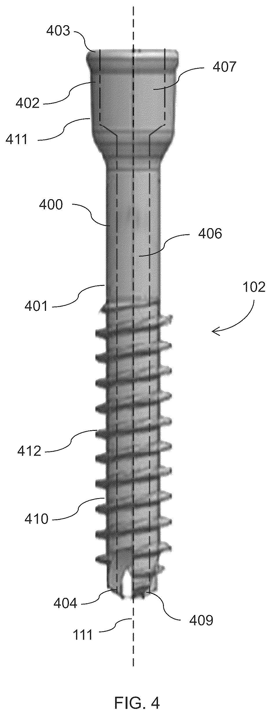 Patent US12310581 Figure 6 – Fixation assembly and method of use