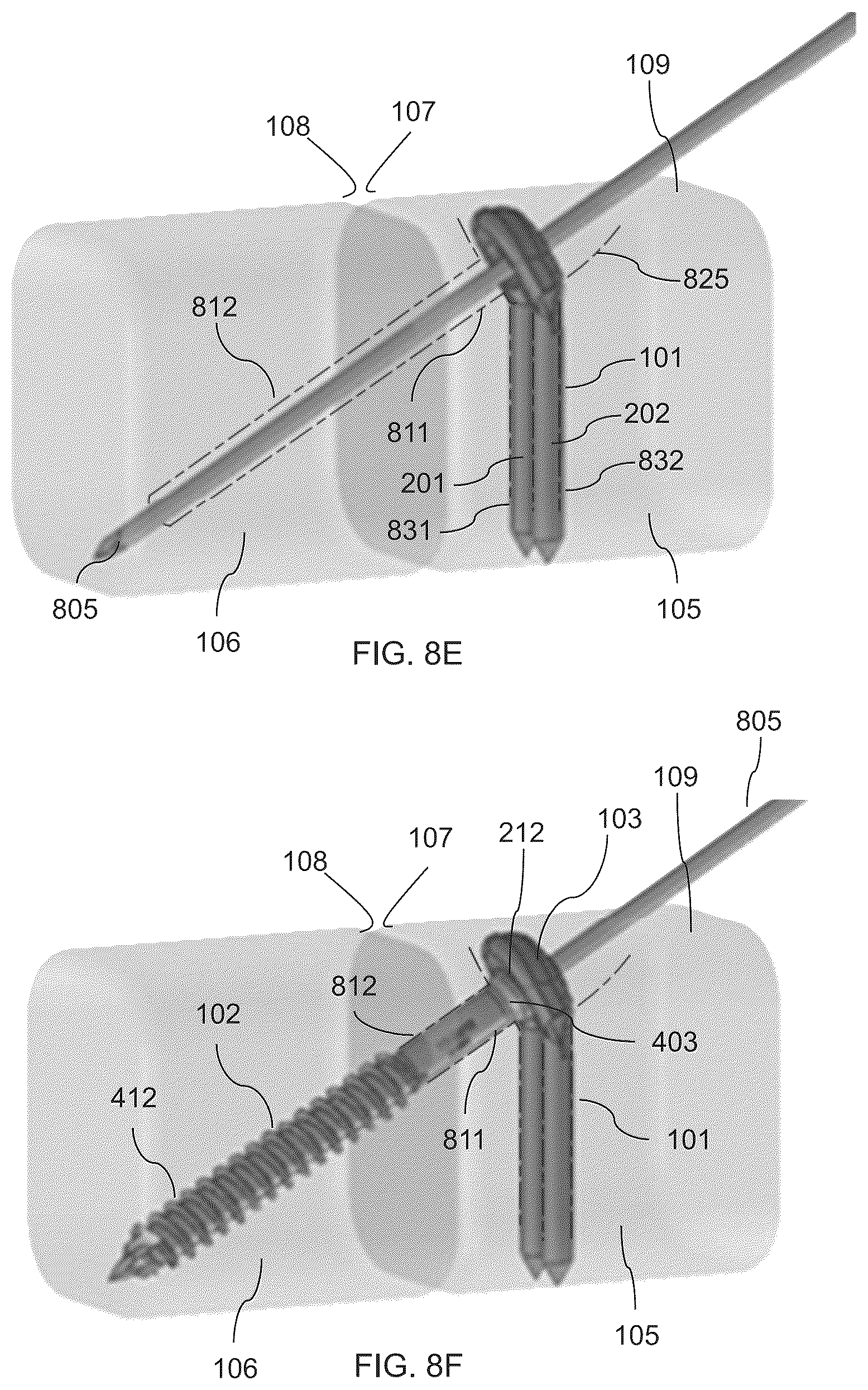 Patent US12310581 Figure 12 – Fixation assembly and method of use