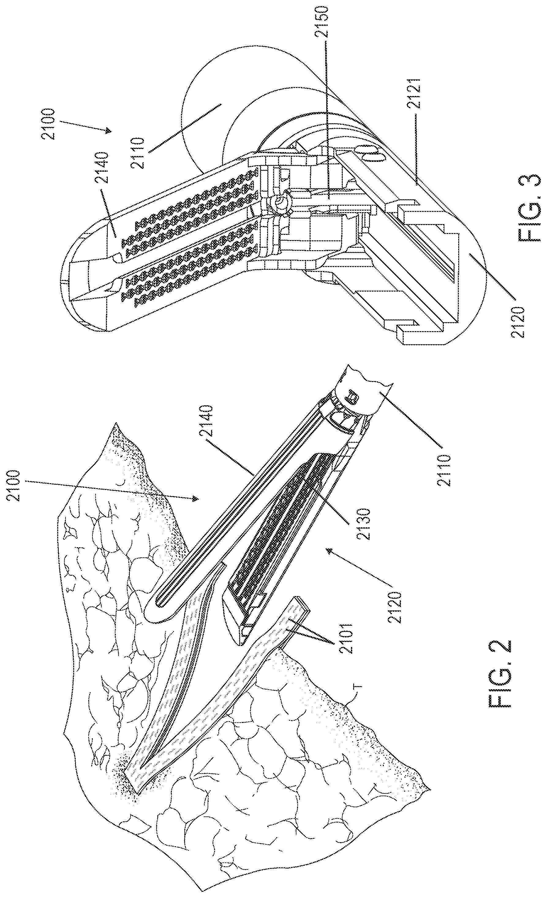 Patent US12310582 Figure 2 – Control circuit for actuating motorized function of surgical stapling instrument utilizing inertial drive train properties