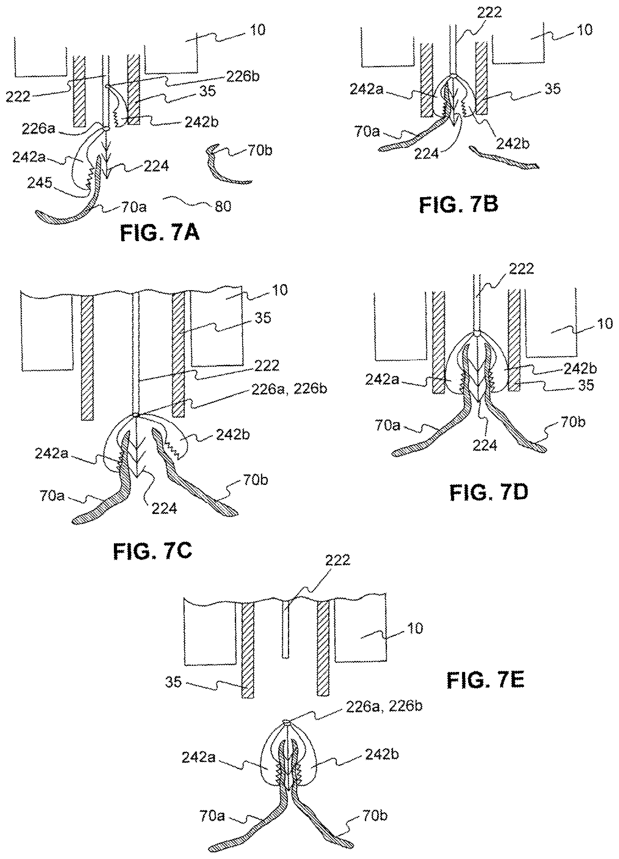 Patent US12310588 Figure 8 – Devices for approximating tissue and related methods of use