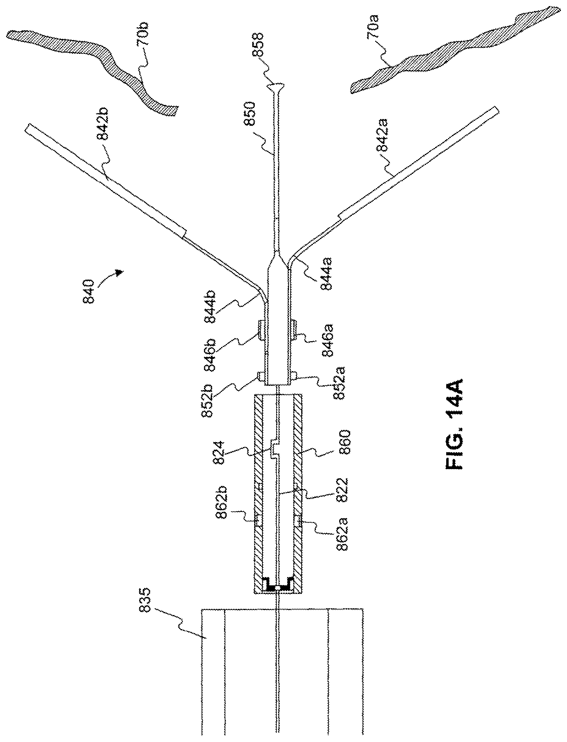 Patent US12310588 Figure 18 – Devices for approximating tissue and related methods of use