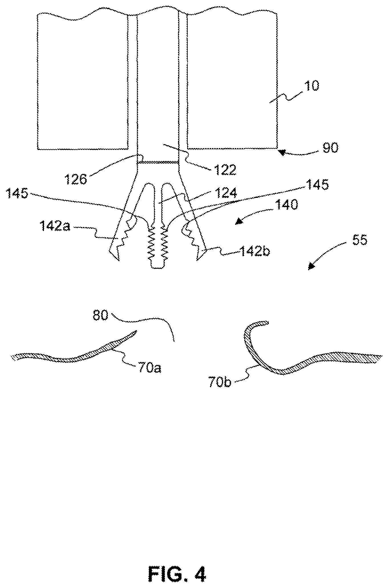 Patent US12310589 Figure 5 – Devices for approximating tissue and related methods of use
