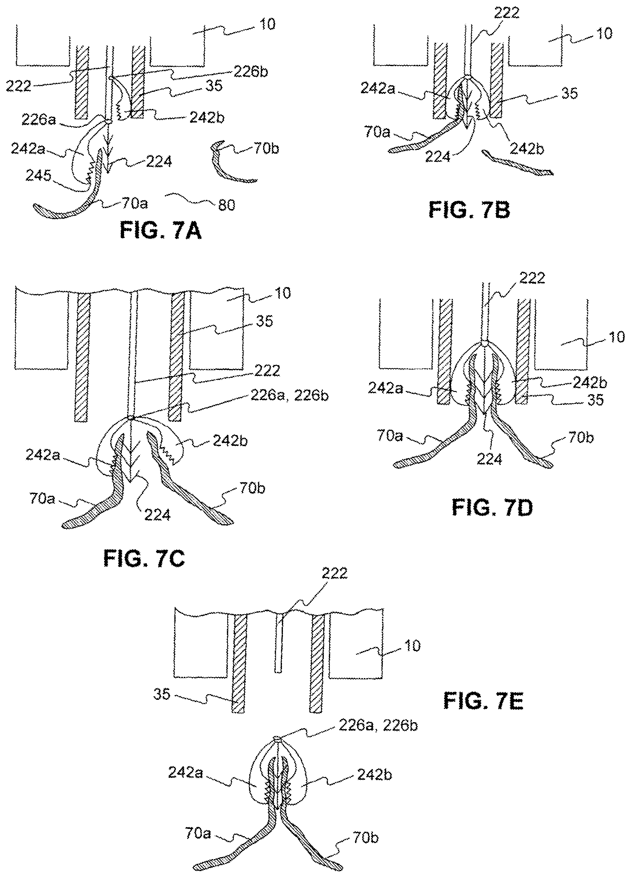 Patent US12310589 Figure 8 – Devices for approximating tissue and related methods of use