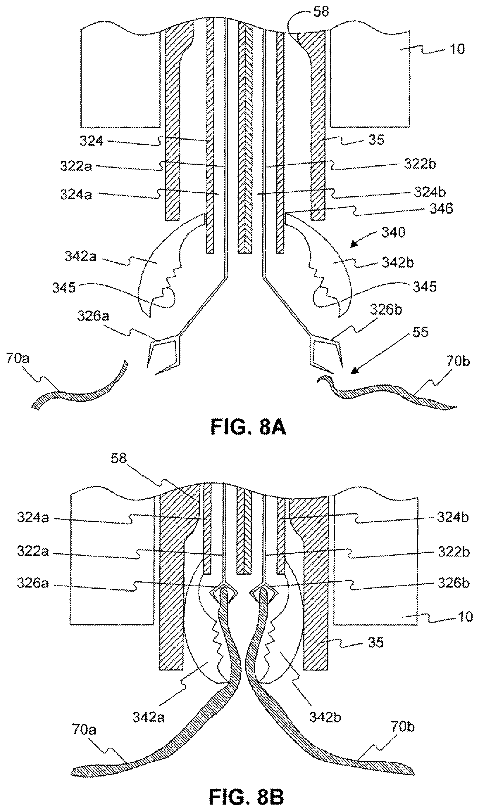 Patent US12310589 Figure 9 – Devices for approximating tissue and related methods of use