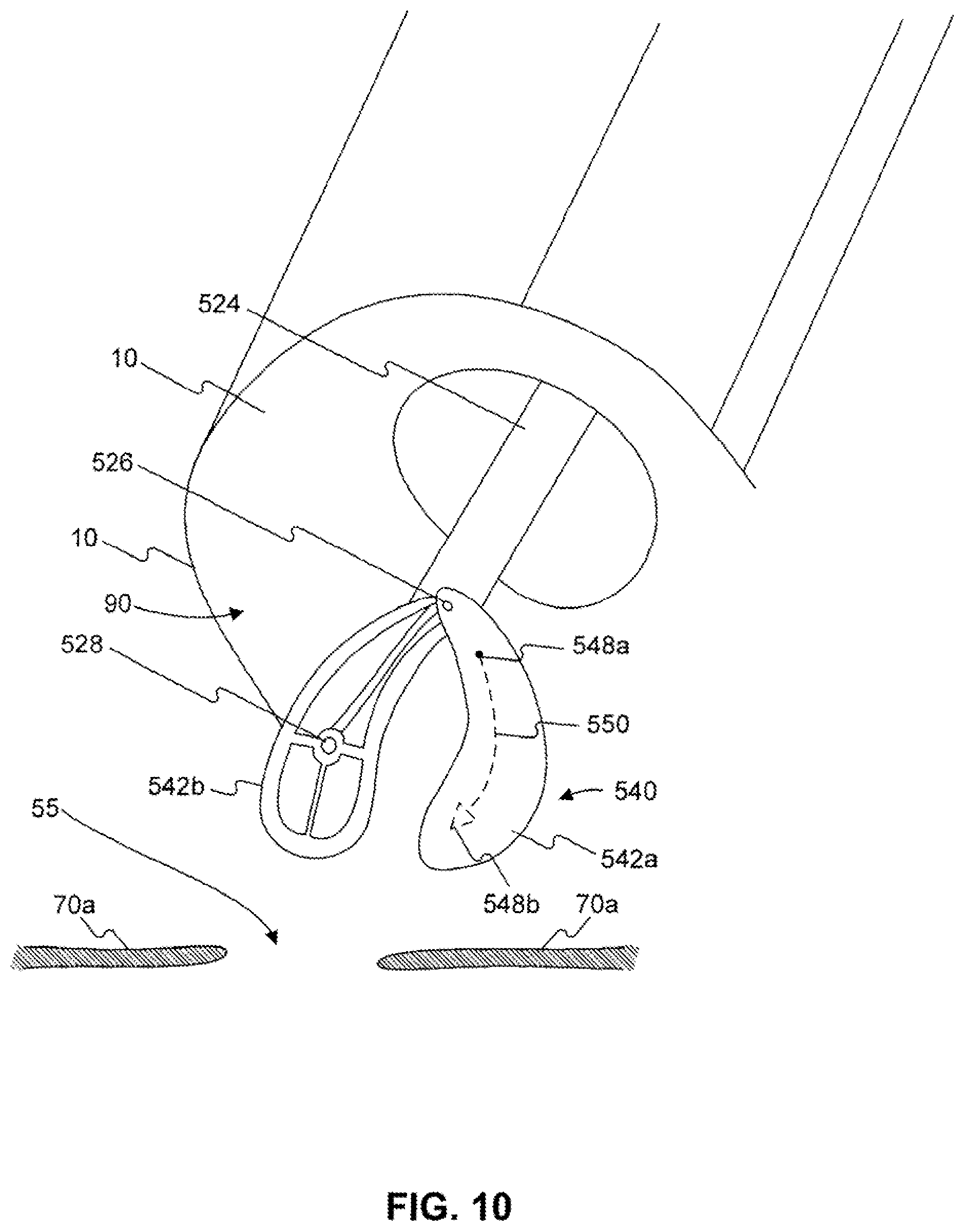 Patent US12310589 Figure 11 – Devices for approximating tissue and related methods of use