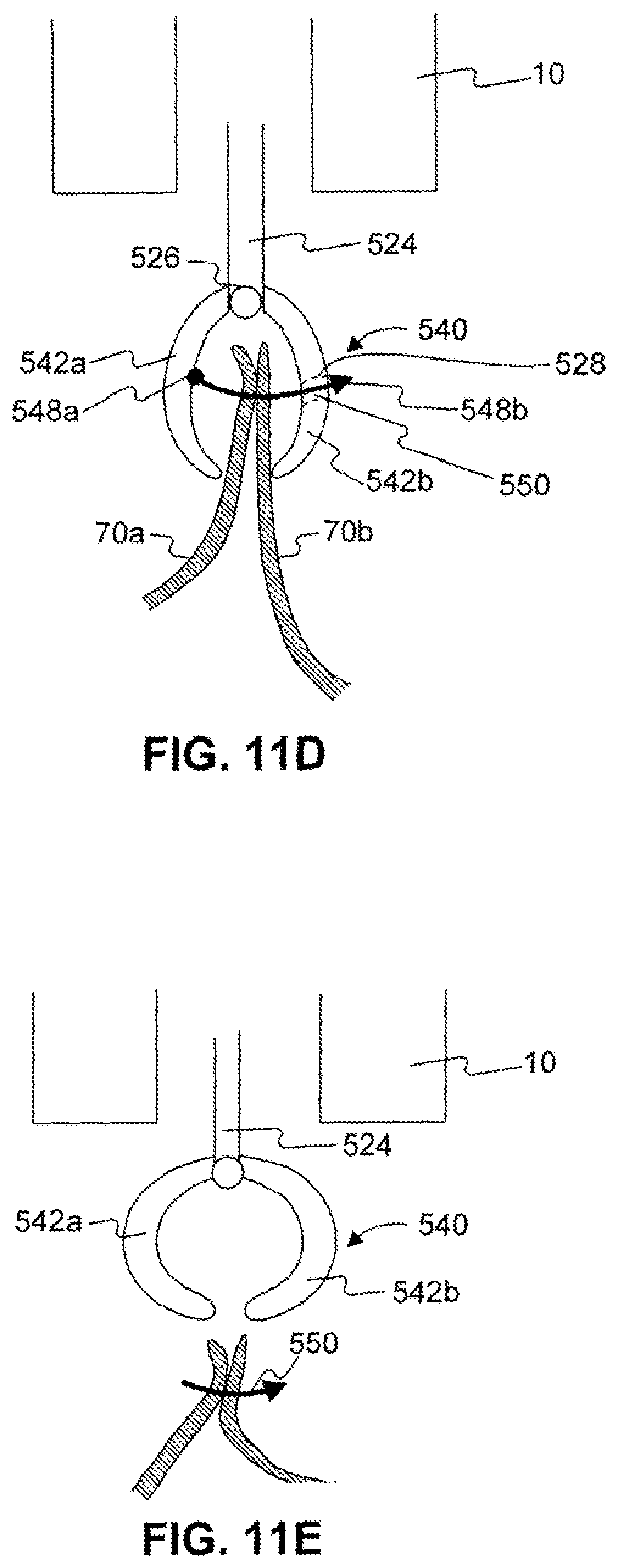 Patent US12310589 Figure 13 – Devices for approximating tissue and related methods of use