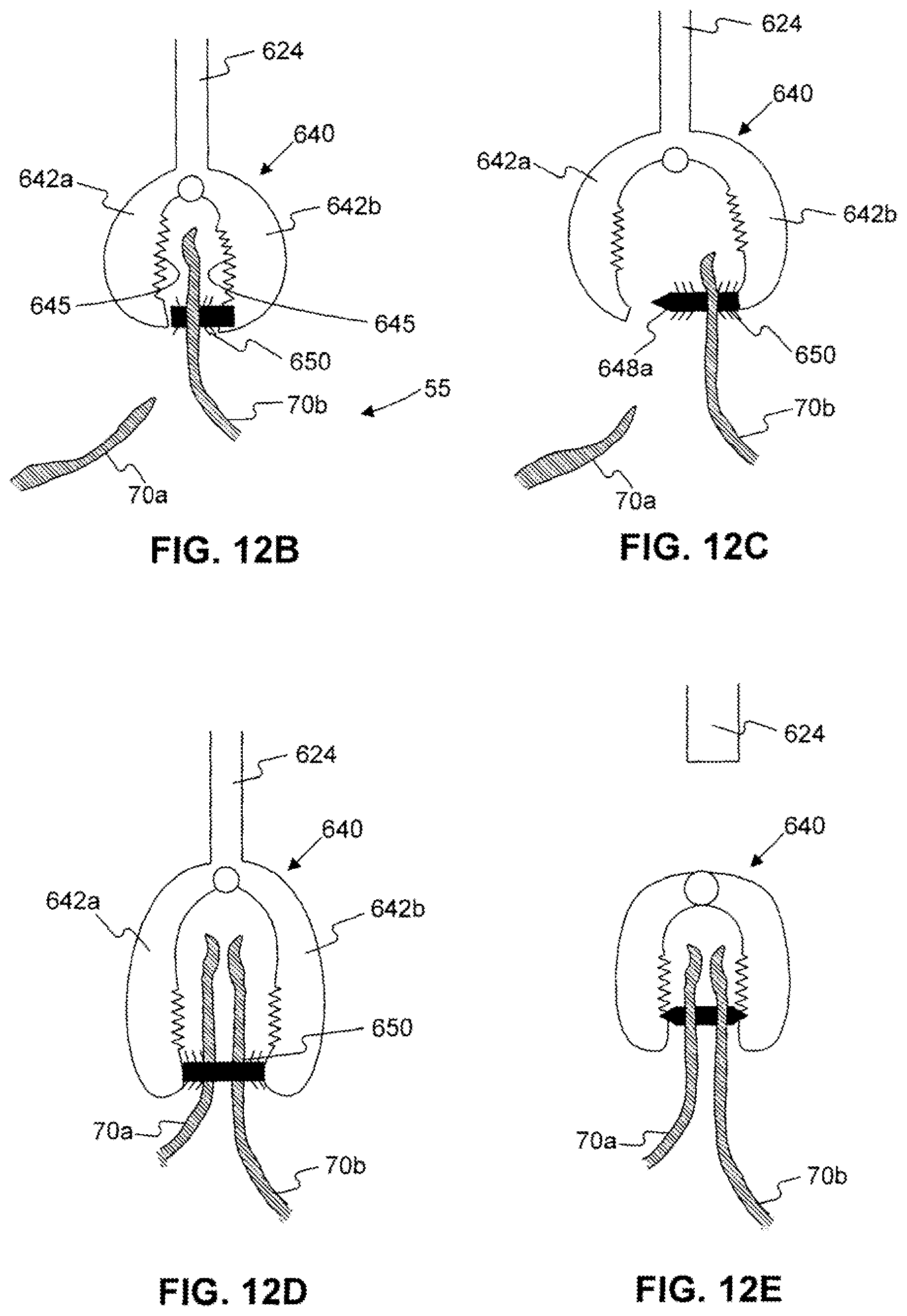 Patent US12310589 Figure 15 – Devices for approximating tissue and related methods of use