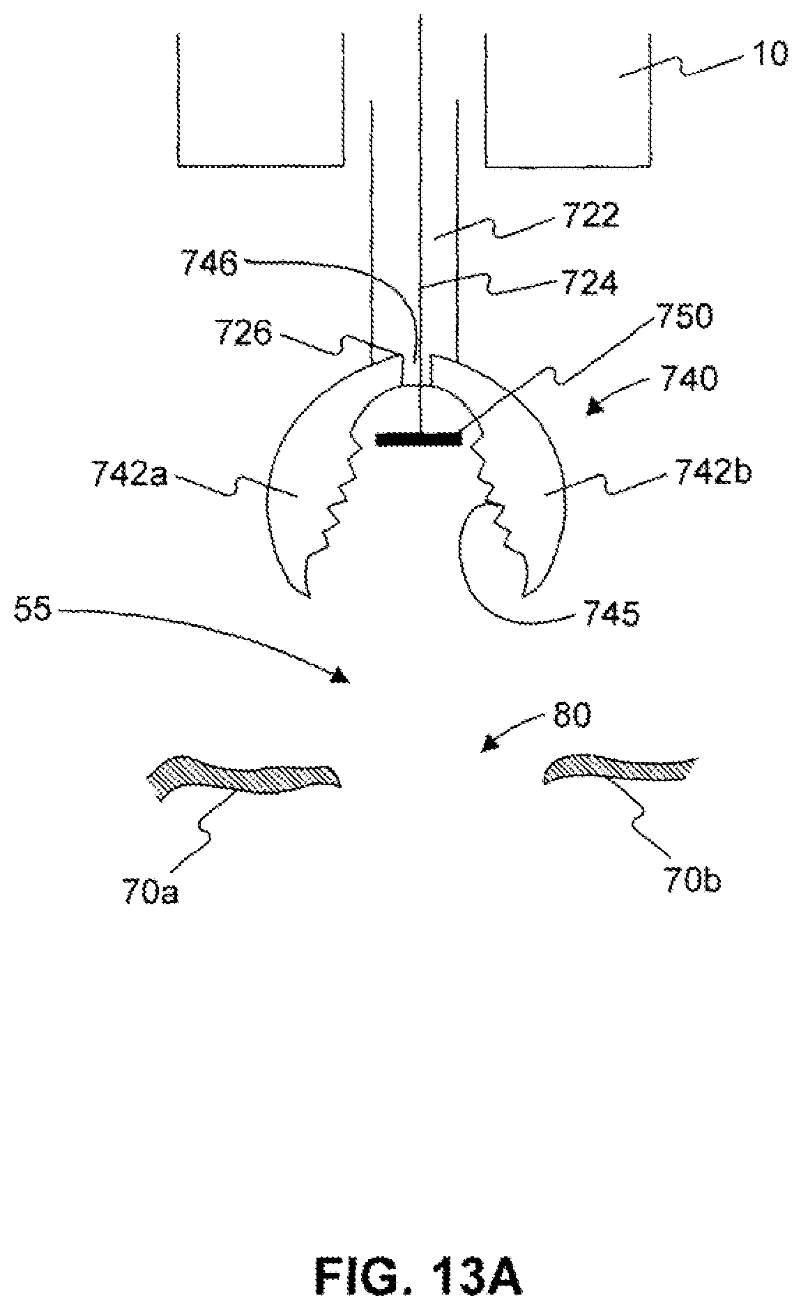 Patent US12310589 Figure 16 – Devices for approximating tissue and related methods of use