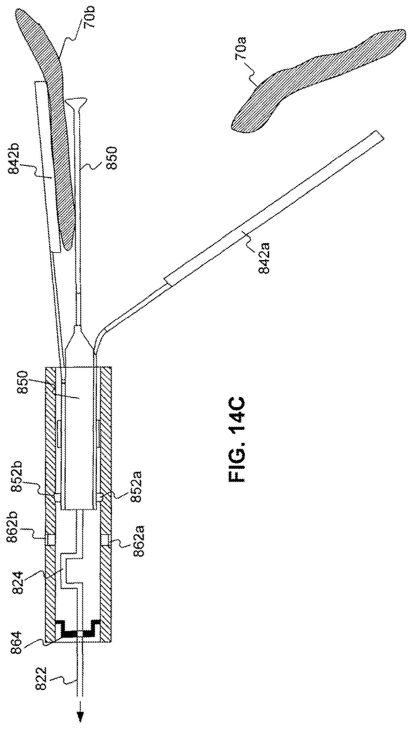 Patent US12310589 Figure 20 – Devices for approximating tissue and related methods of use