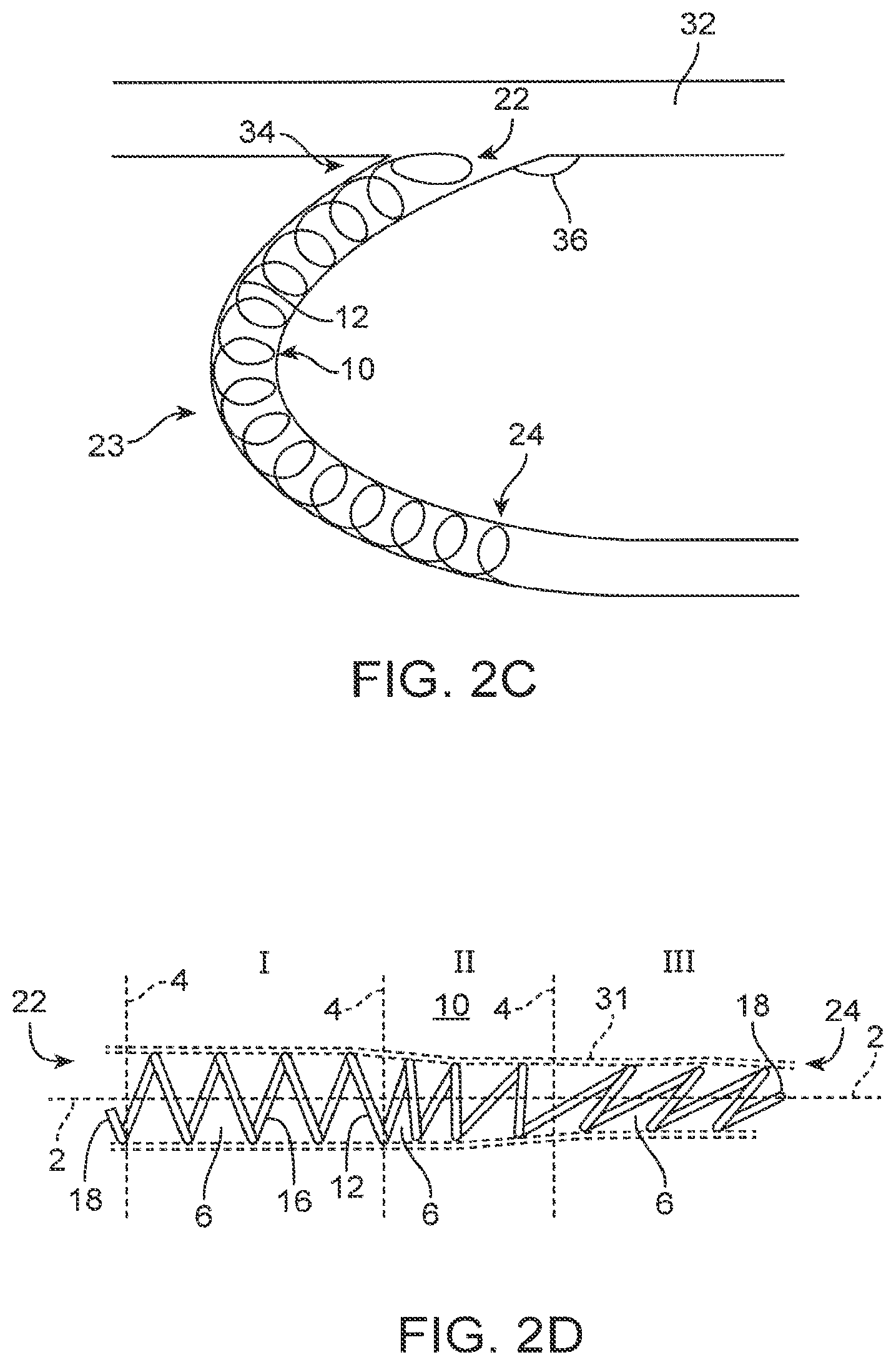 Patent US12310590 Figure 3 – Platform device and method of use to assist in anastomosis formation
