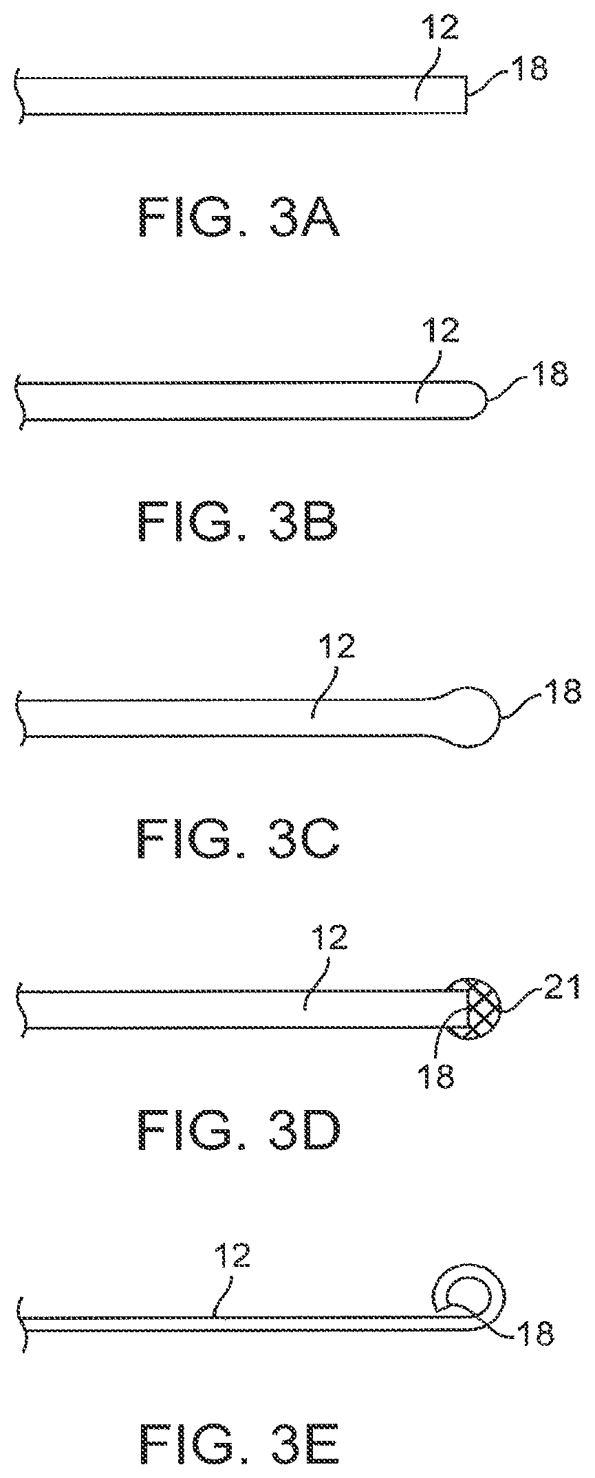Patent US12310590 Figure 4 – Platform device and method of use to assist in anastomosis formation