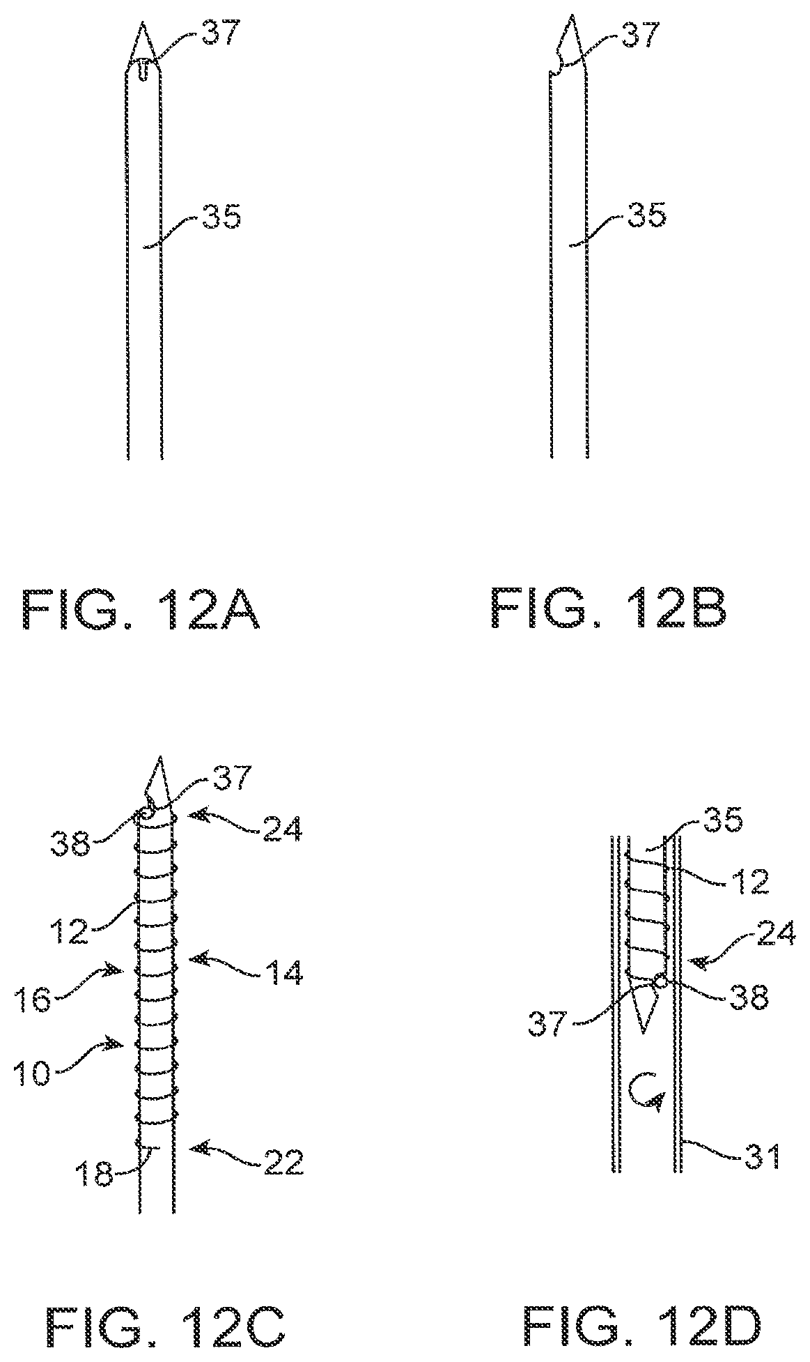 Patent US12310590 Figure 13 – Platform device and method of use to assist in anastomosis formation