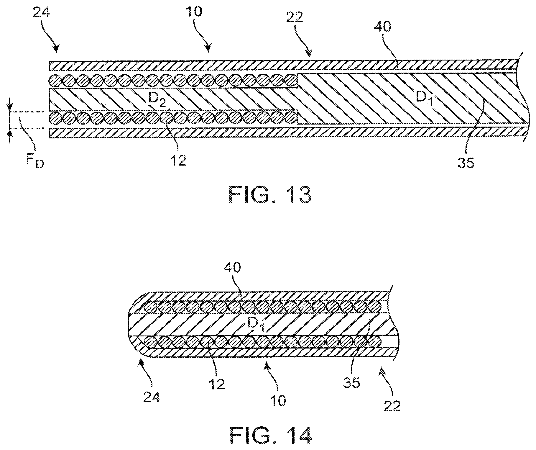 Patent US12310590 Figure 15 – Platform device and method of use to assist in anastomosis formation
