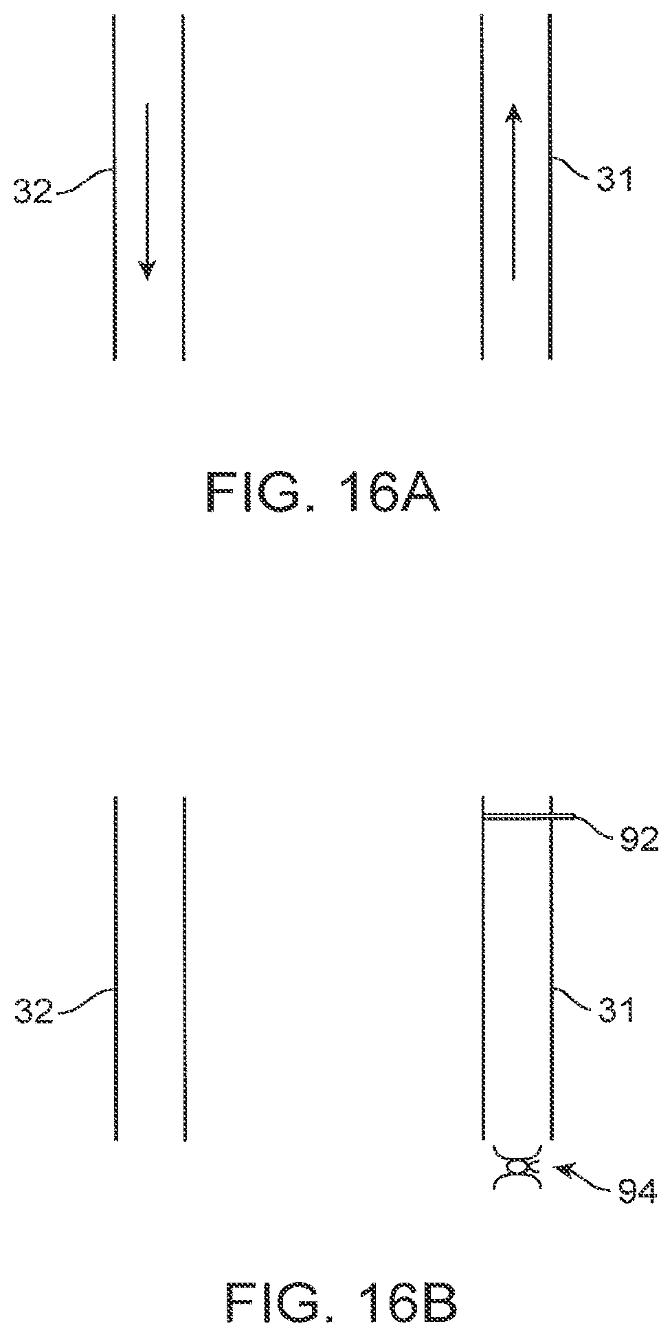 Patent US12310590 Figure 17 – Platform device and method of use to assist in anastomosis formation