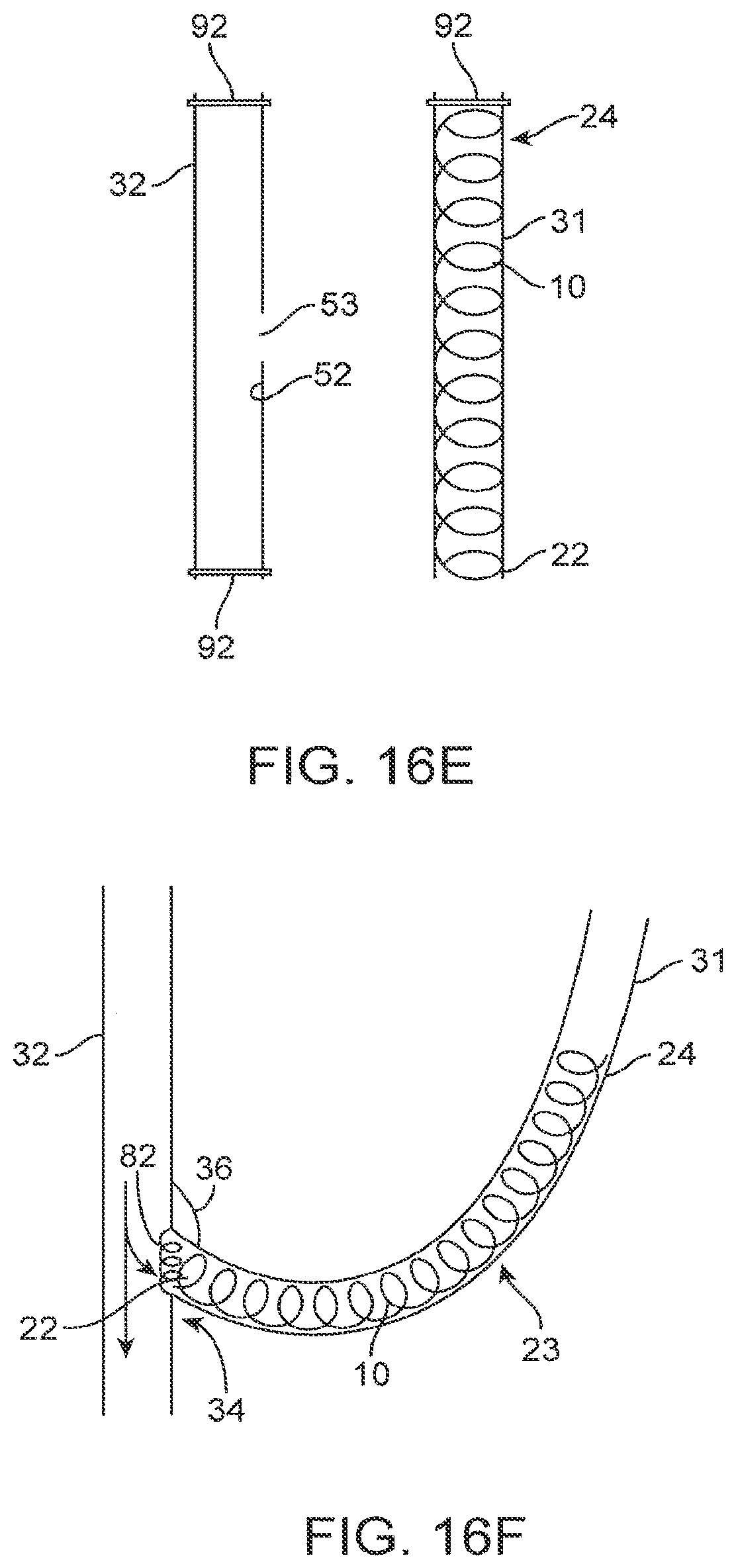 Patent US12310590 Figure 19 – Platform device and method of use to assist in anastomosis formation