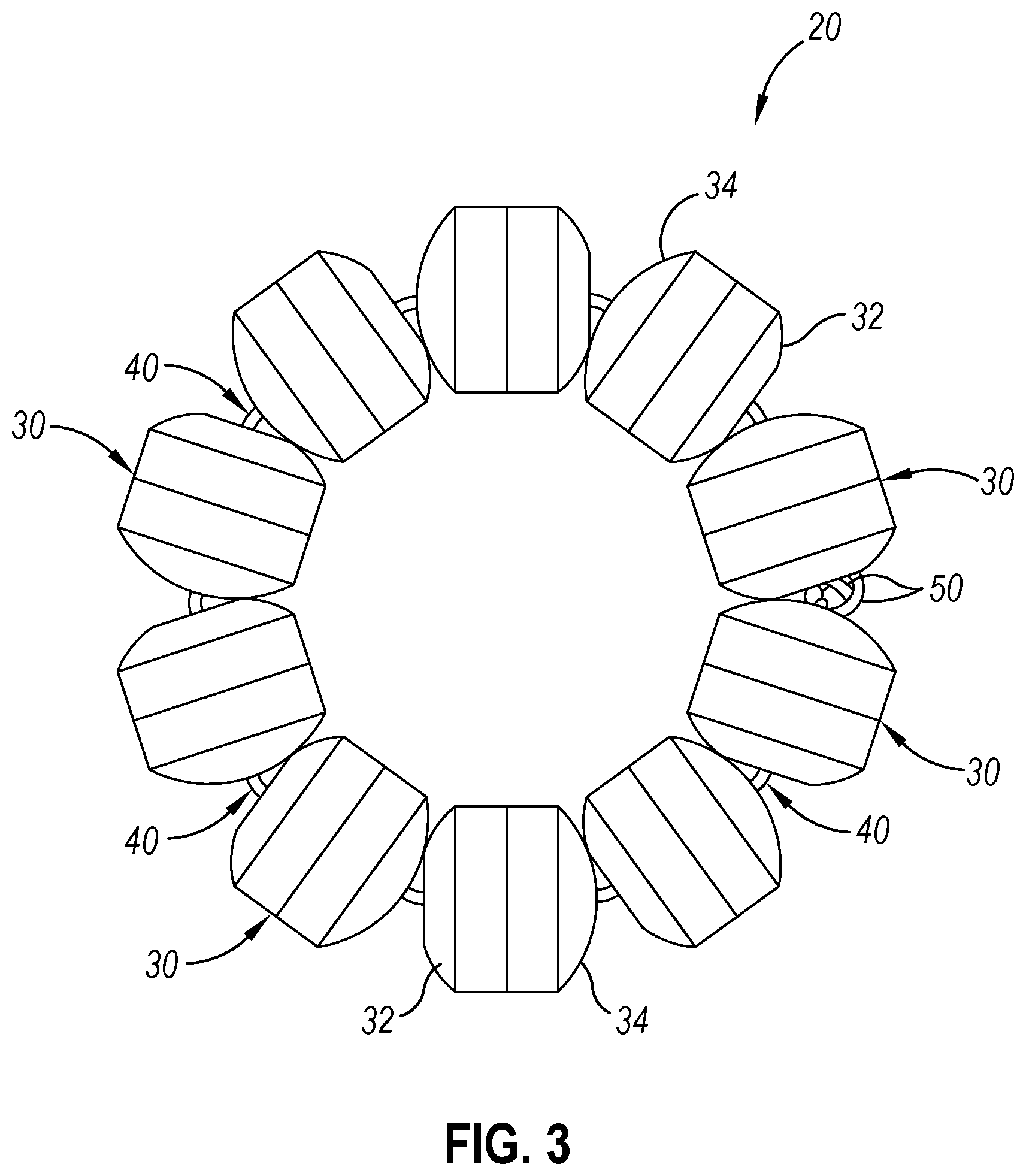 Patent US12310593 Figure 3 – Implantable sphincter device with bead orientation control based on bead interactive geometry