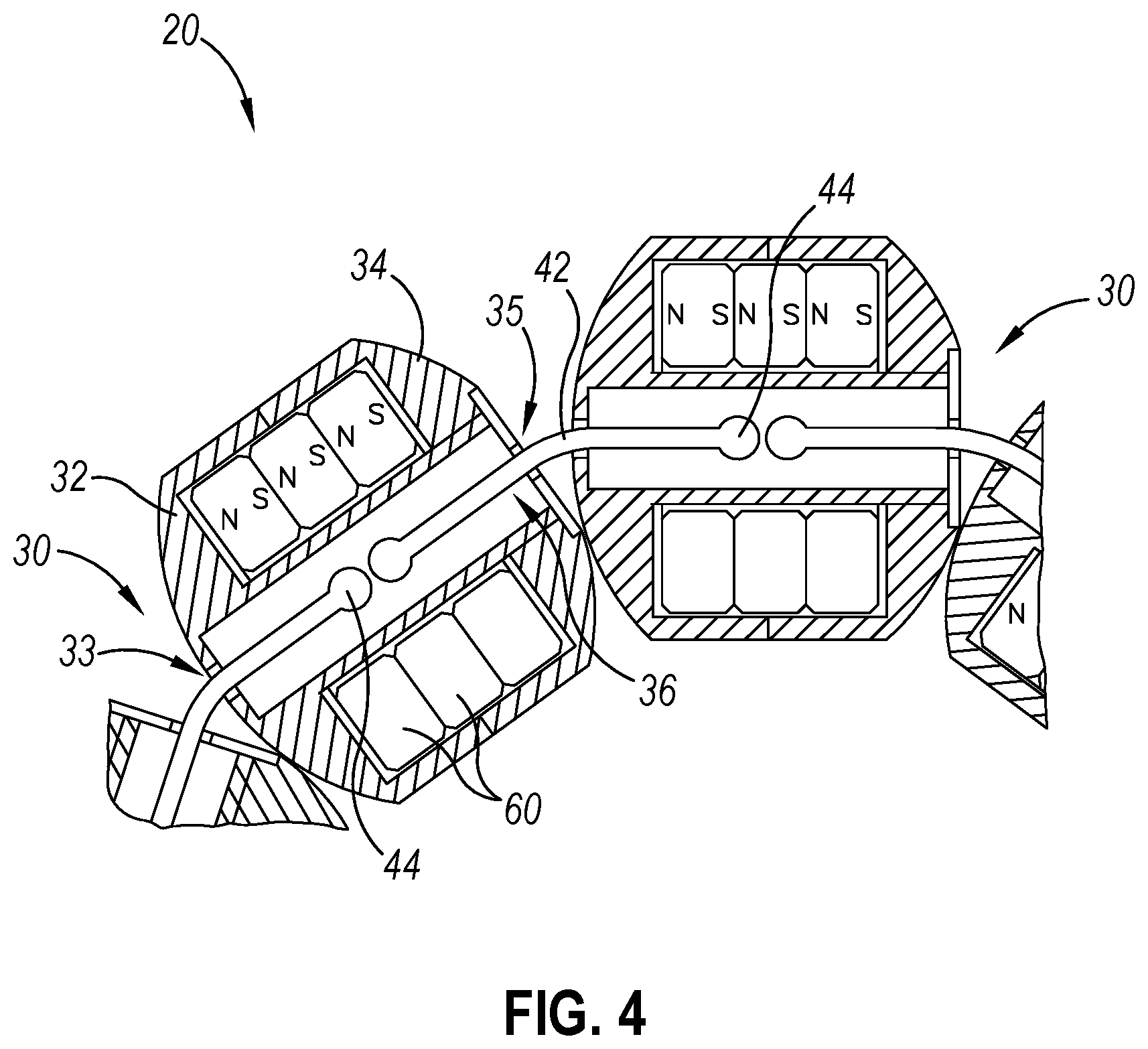 Patent US12310593 Figure 4 – Implantable sphincter device with bead orientation control based on bead interactive geometry