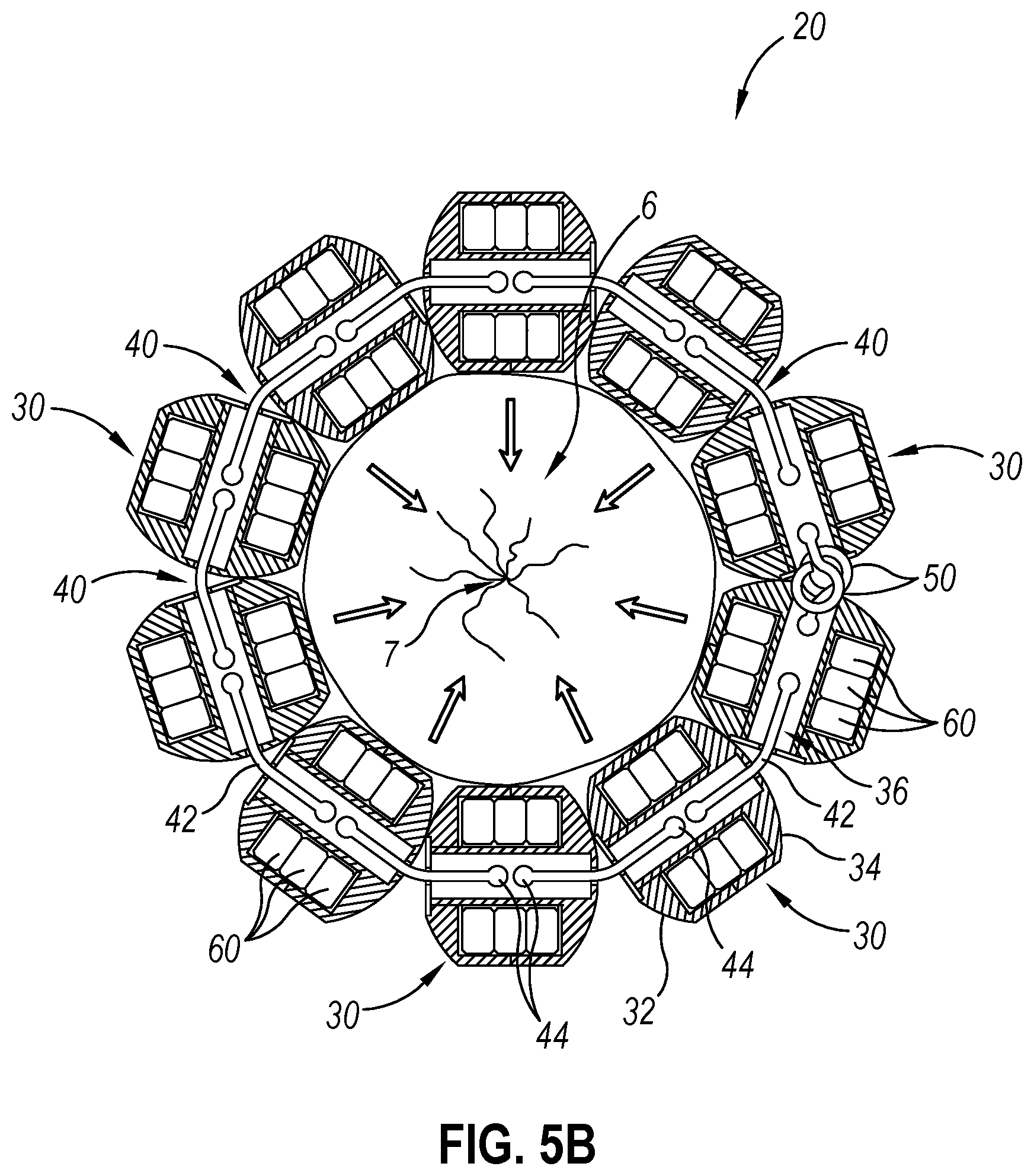 Patent US12310593 Figure 6 – Implantable sphincter device with bead orientation control based on bead interactive geometry