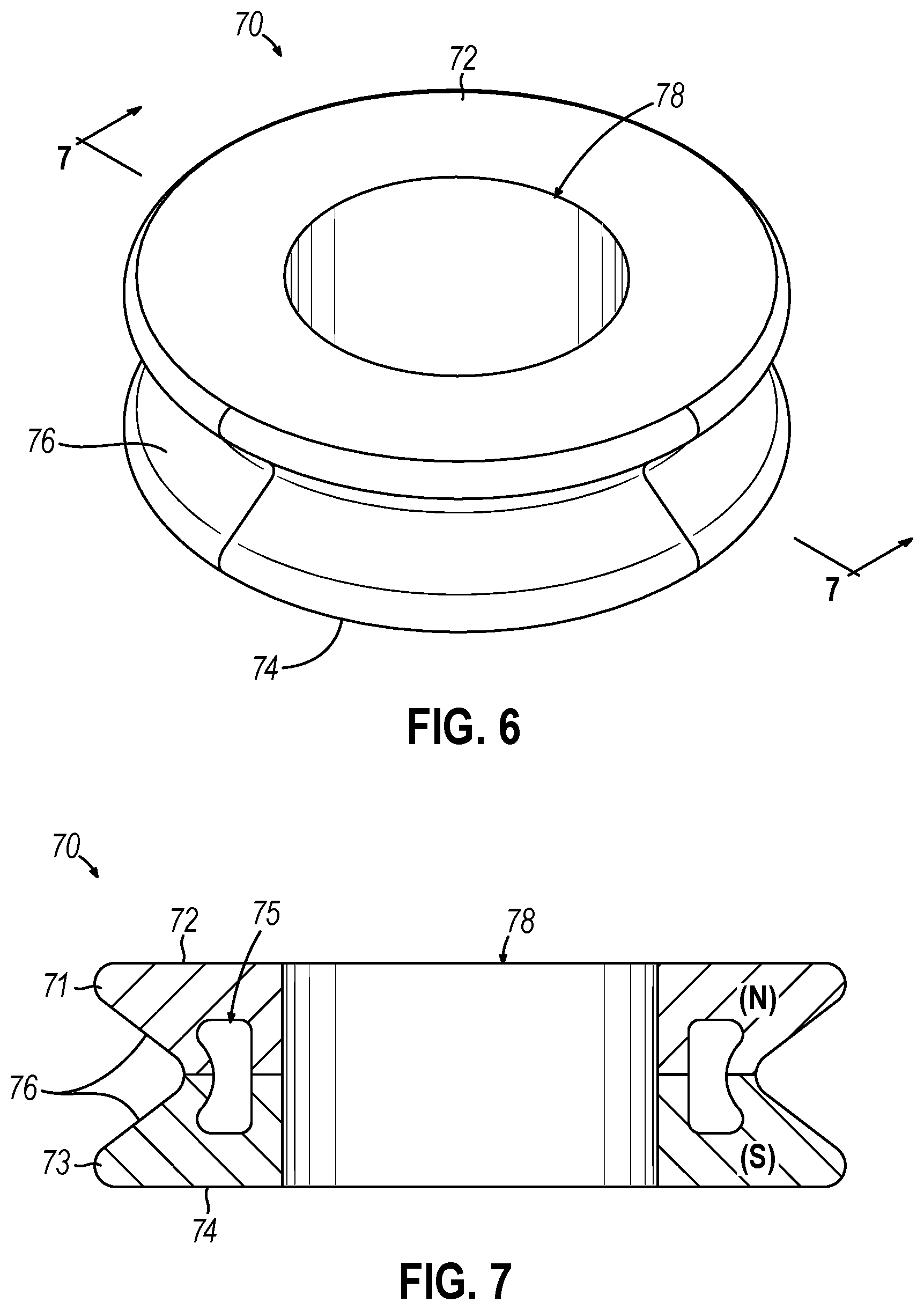 Patent US12310593 Figure 7 – Implantable sphincter device with bead orientation control based on bead interactive geometry