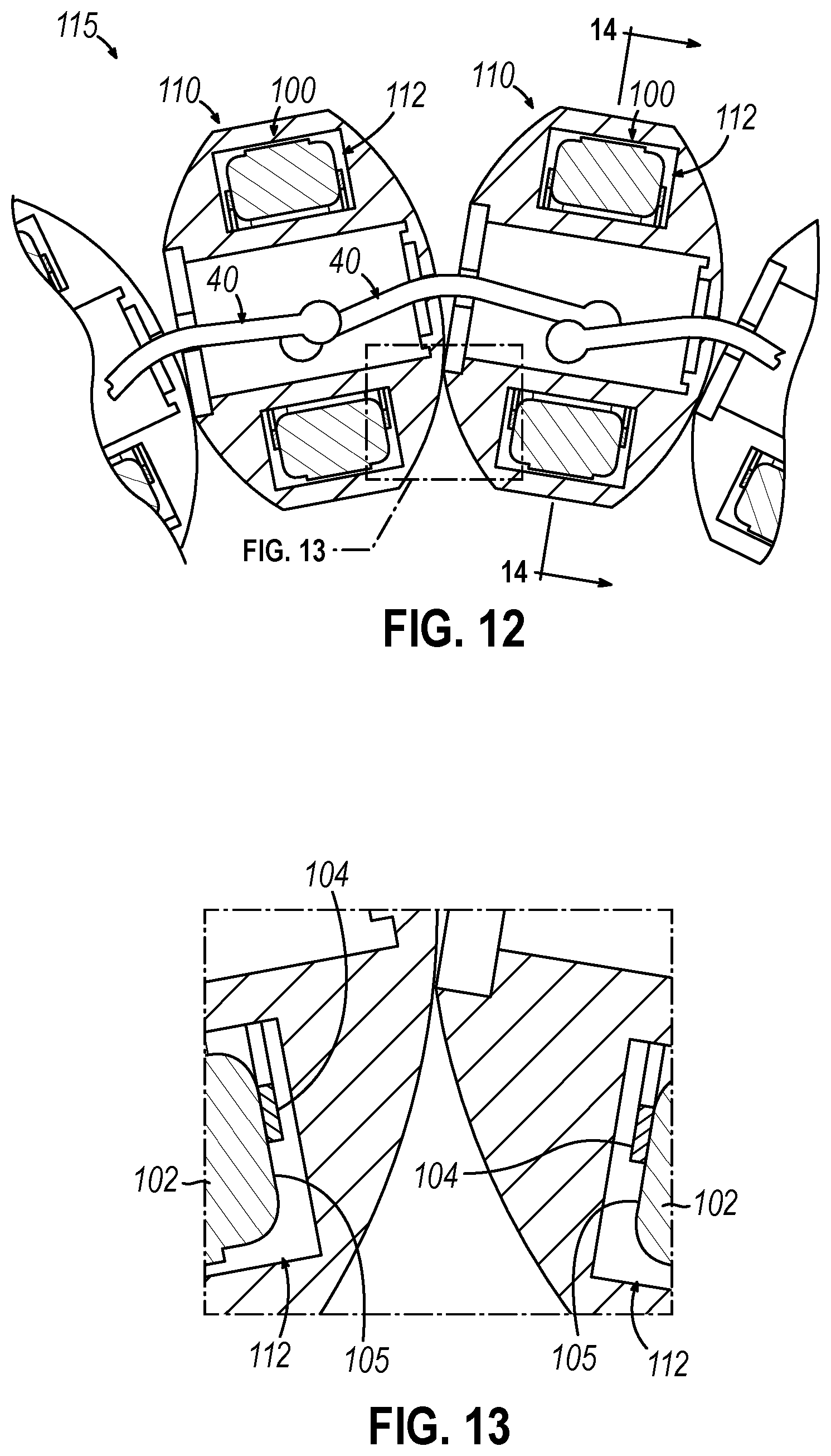 Patent US12310593 Figure 10 – Implantable sphincter device with bead orientation control based on bead interactive geometry