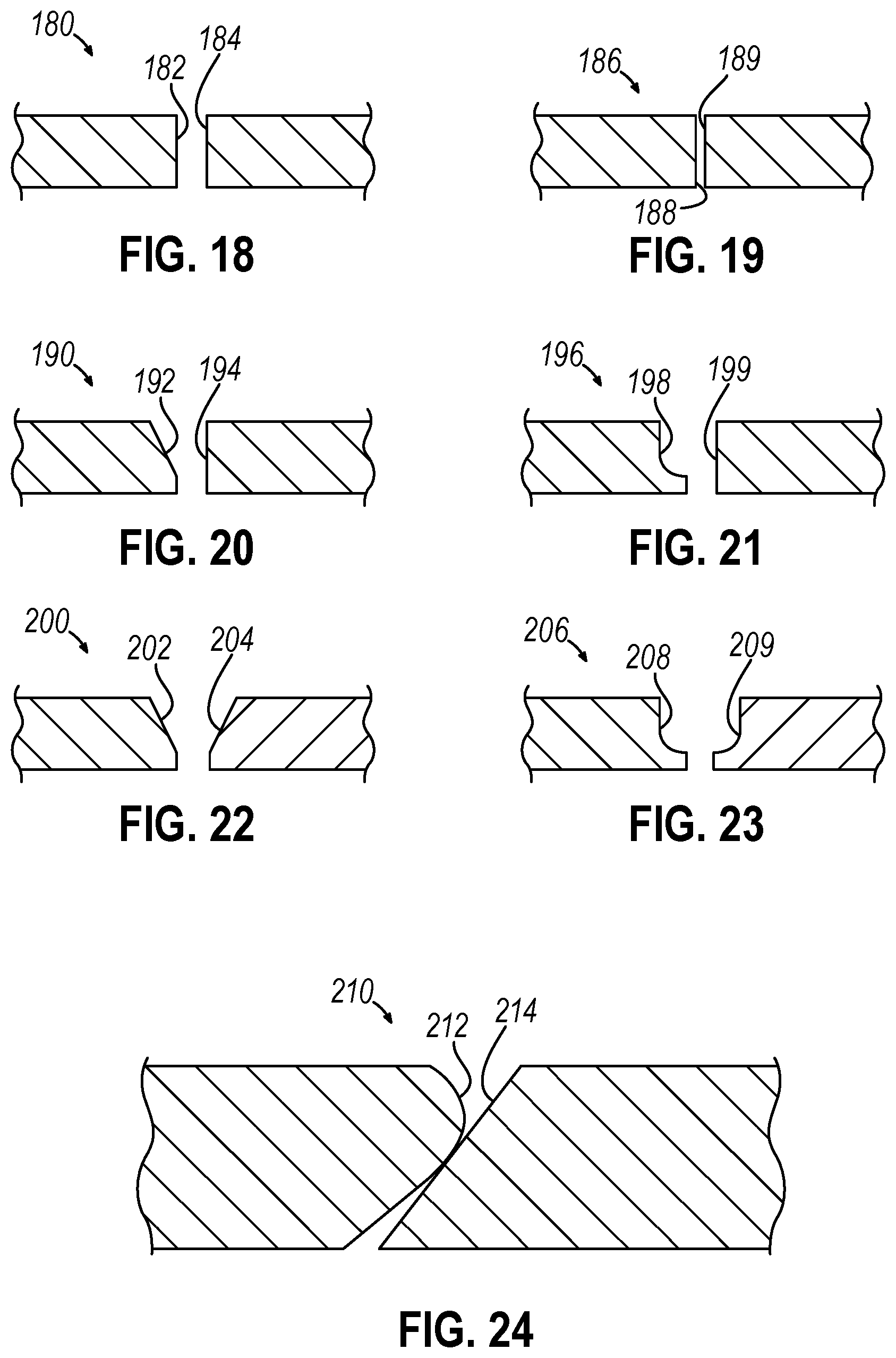 Patent US12310593 Figure 13 – Implantable sphincter device with bead orientation control based on bead interactive geometry