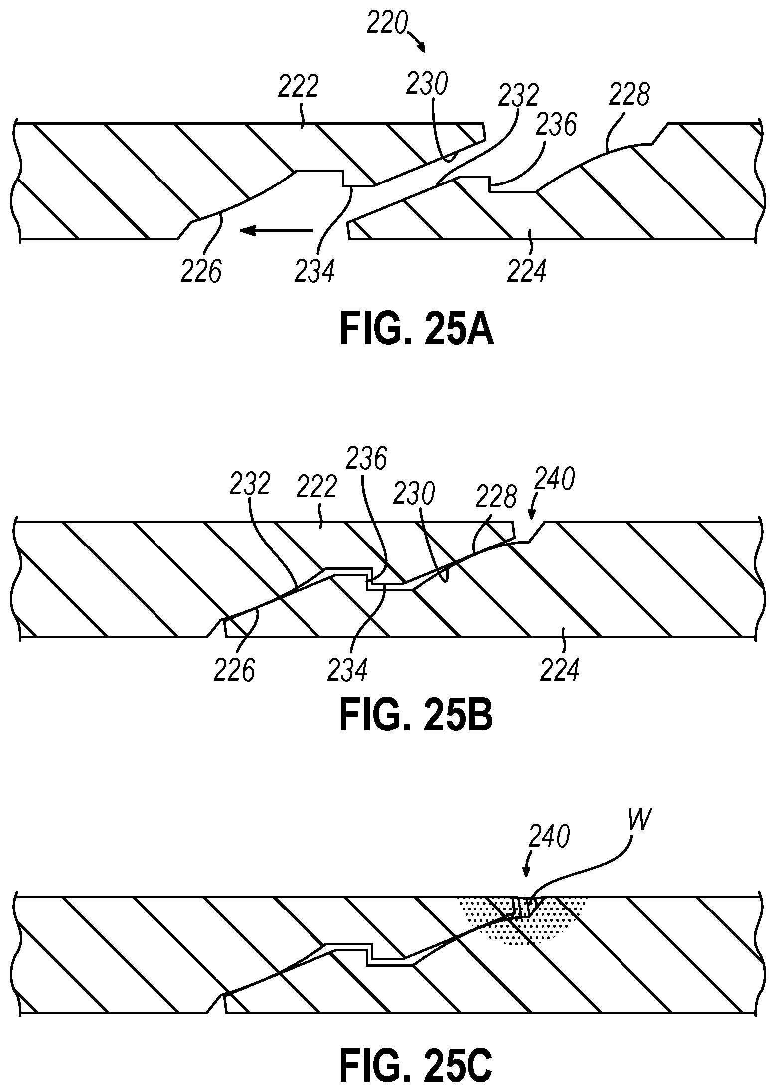 Patent US12310593 Figure 14 – Implantable sphincter device with bead orientation control based on bead interactive geometry